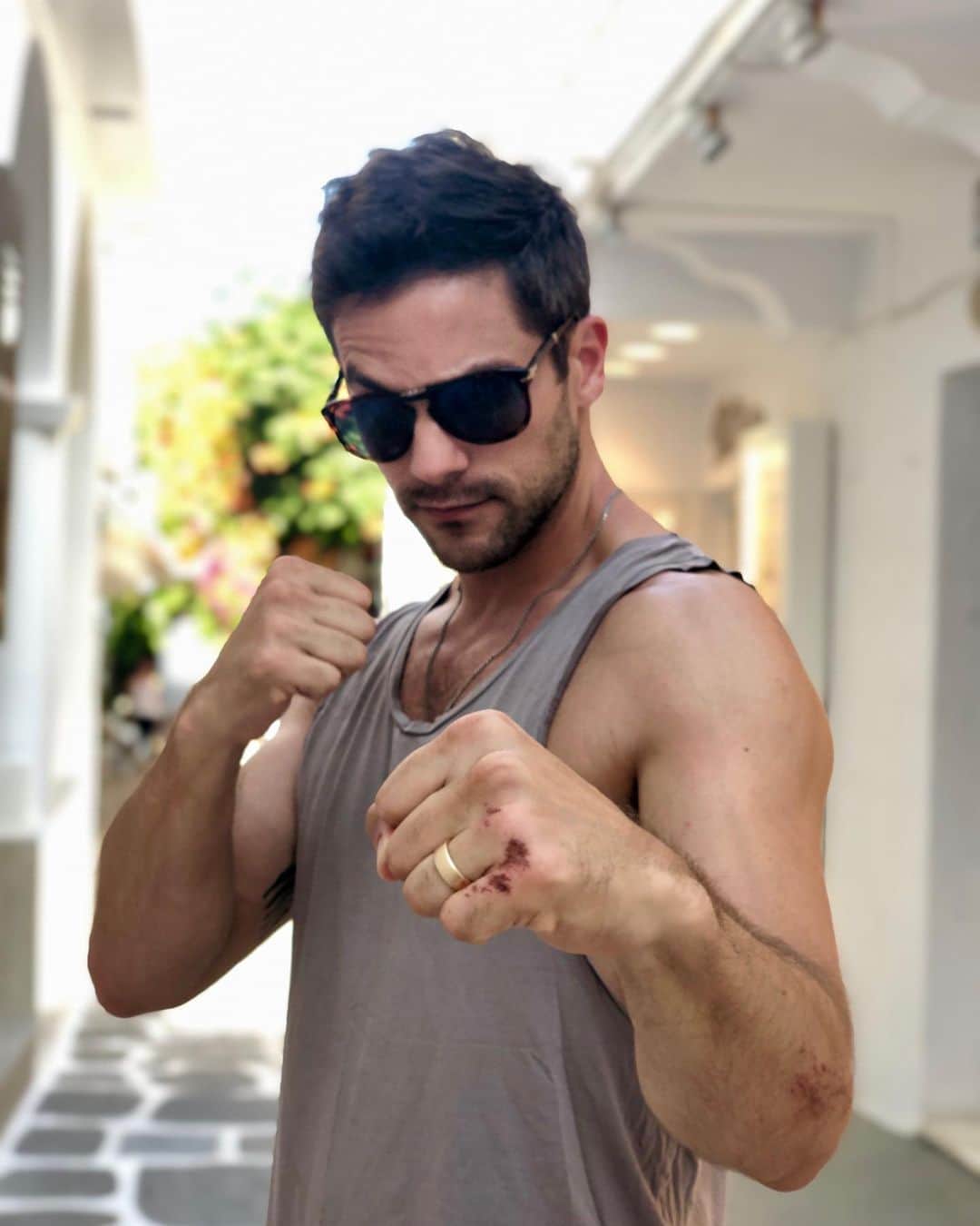 ブラント・ドーハティのインスタグラム：「You should see the other guy. Okay so it wasn’t a guy. It was a scooter. But I fucked him up good.」