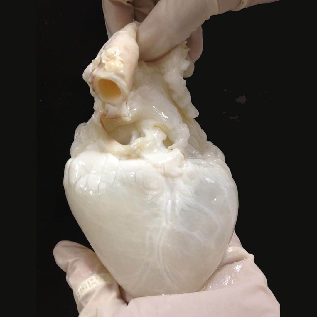 TED Talksのインスタグラム：「Doesn’t this look like a ghost heart?? It’s actually a pig heart. We know that’s slightly less exciting, but the reason why it looks translucent is still pretty cool — the living cells were washed off using a soap solution, which bursts the cells and leaves only the protein structure behind. This lets the heart serve as a scaffold to grow a new working heart out of human stem cells. Believe it or not, scientists at the Texas Heart Institute have successfully implanted tissue-engineered hearts like this one into rats and pigs. Next up: humans! You can read about this and other bio-engineering experiments in the TED Book, “Super Cells.” Photo courtesy of RMR Labs, Texas Heart Institute」