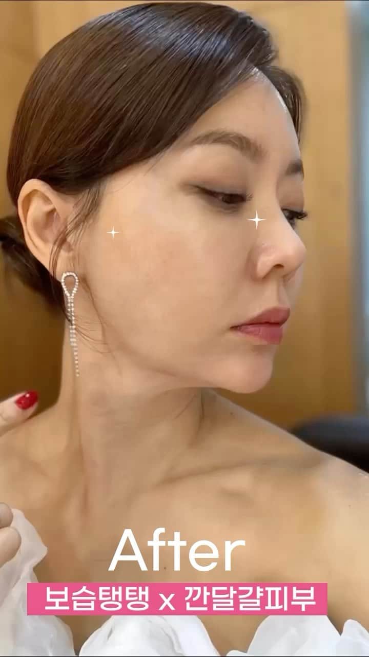 アン・ソニョンのインスタグラム：「숨겨왔던 비밀을 공개합니다!😎  요즘 더 젊어보이는이유!! 지루성 피부염으로 고생하다가 깐 달걀 피부 됐어요   홈쇼핑, 협찬 등등 정말 정말 많은 화장품을 직접발라보며 터득한 깐깐함 아시죠?  안선영이 N통째 비운 이것!  이런 고민 하나라도 해당된다면, 이번기회 놓치지 마세요! - 피부가 얇고 건조하다  - 얇은 각질이 잘 생긴다 - 칙칙하고 푸석푸석한 피부톤이 고민인다 - 표정주름이 유난히 도드라져 보이기 시작했다 - 볼살의 탄력이 예전만 못하다   보습 저분자, 중분자, 고분자 입자로  피부 속 건조부터 잡아주는 멀티 레이어링 수분 충전 !   자극테스트 0 저처럼 민감한 피부도 추천하는  비건 화장품 브랜드 RTL (라프텔)  단, 2주 사용 테스트결과  피부보습도 80.5% 개선  주름개선 22.83% 안면 볼 탄력 개선 29.01%  [구성] ✔️모닝세트 =>34%할인 꽃수토너+AM7세럼+톤업선크림  하루종일 촉촉하고 맑은피부로 케어가 필요하다면!   ✔️나이트세트 =>38%할인 PM10세럼+아이크림  비건아미노산의 영양& 탄력케어가 필요하다면!  특별히 첫 공구오픈 이벤트로 + 매일 선착순 100분께 라프텔 파워리프트 마스크팩 본품 증정 (정가2만원/세트 구매 시)   + 선착순 100분께는 쿨걸 그날 패치 + 아로마패치 세트 (정가 28,900원) 선물도 보내드려요 🥰  구매는 프로필 링크를 클릭하세요 !」