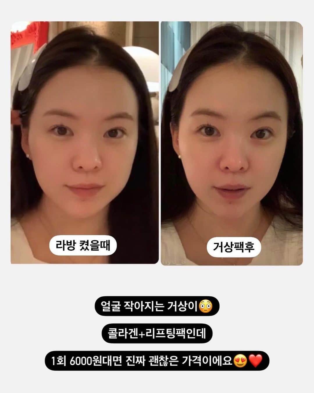 ハヌルさんのインスタグラム写真 - (ハヌルInstagram)「후기가 말해주는 거상팩🔥🔥 두달만에 돌아왔어요!!!!  쫘악 끌어올려준 상태에서 그래도 리프팅 고정 시켜주니까!!! 두시간만에 다들 엄청난 효과가 ㅋㅋ  저희 오픈하면 2만박스씩 판매되는 거상팩이에요!! 실제로 연예인분들도 촬영아침 샵가는길에 하시는 팩으로도 유명한 거상팩!!!!  저도 중요한날 전날, 당일관리로 꼭 해줍니다 하고 안하고가 다르거든요!!  왠만한 리프팅관리보다 나아요💛 콜라겐 53%라 피부도 좋아지구요😺💛  돌아오는 월요일 11시 오픈입니다! 이번에 선착순 700명 갈바닉LED디바이스 드려요!!!✨」12月16日 15時05分 - haneulina