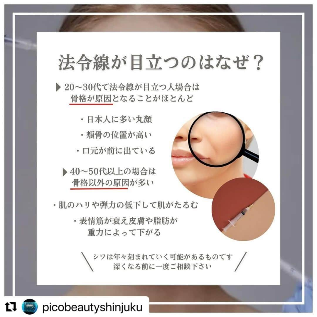 YAG BEAUTY CLINICさんのインスタグラム写真 - (YAG BEAUTY CLINICInstagram)「#Repost @picobeautyshinjuku with @use.repost ・・・ 法令線ヒアルロン酸とは？？ どんな骨格やどんな原因でできるのか？？ご紹介しています💁‍♀️ 自分は何に当てはまるかな？ 是非一度当院へご相談下さい💜  ご予約・お問い合わせにつきましては当院までお電話お待ち致しております🙇‍♀️ 💎PICO BEAUTY CLINIC💎 〒160-0022 東京都新宿区新宿3-29-17新盛堂ビル8階 📲0120-900-253  #美容クリニック #美容外科 #美容皮膚科 #美容看護師 #picobeautyclinic #ピコビューティークリニック #ピコレーザー #新宿東口 #新宿 #ピコシュア #ピコトーニング #ピコフラクショナル#ピコスポット #シミ取り #シミ取り放題 #ピコシュアならピコビューティークリニック  #肌育  #アンチエイジング　#スキンケア #美白ケア #ダウンタイム #若返り #肌治療 #肌悩み #たるみ #シワ #ほうれい線 #ヒアルロン酸とは #ヒアルロン酸注入   @yagbeauty_official」11月24日 12時28分 - yagbeauty_official