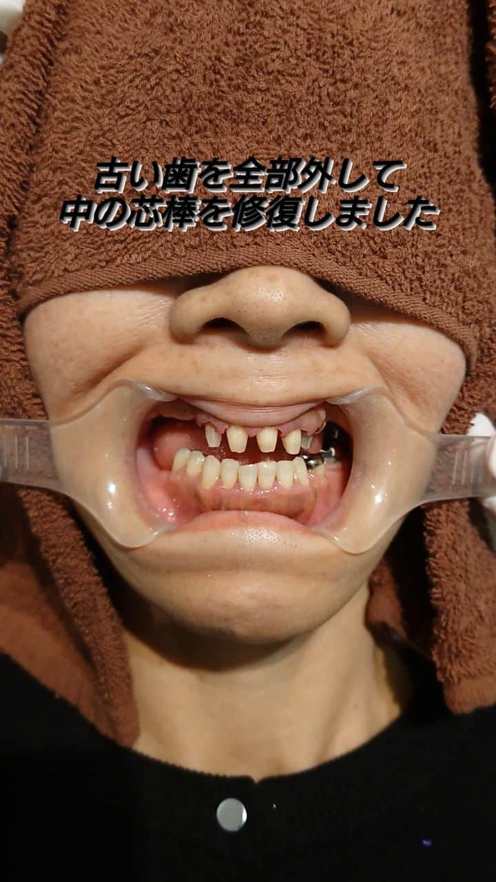 のインスタグラム