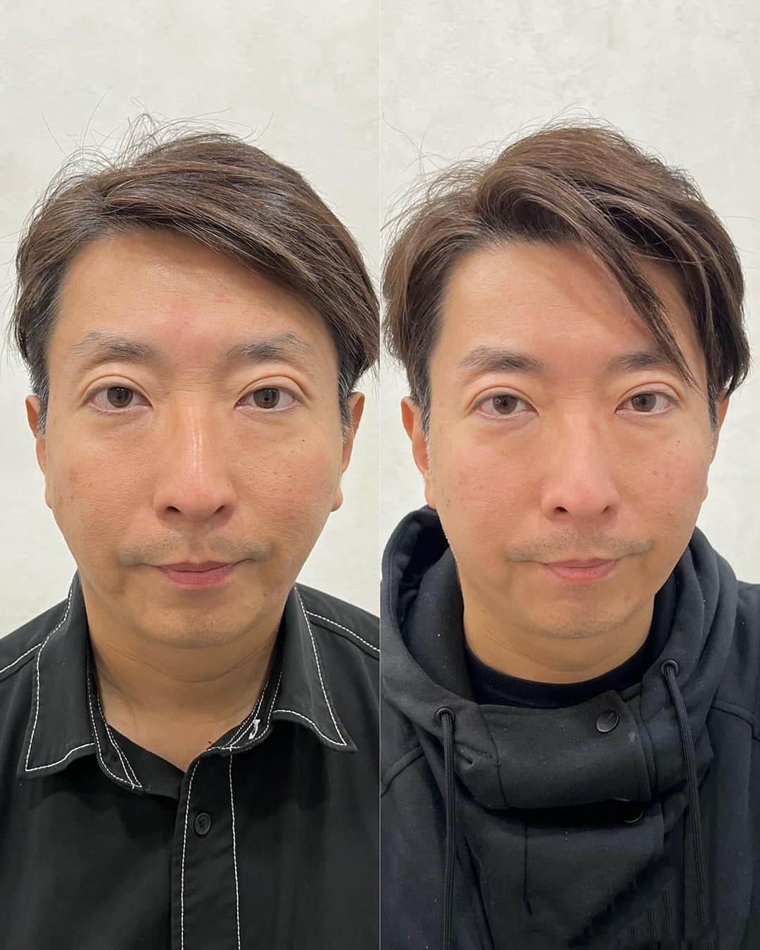 有村昆のインスタグラム：「前からずっとやってみたかったアートメイク。友達のあいちゃんにやってもらったら、ノーメイクでも自然な眉毛になりました。 アートメイクと言うと、女性に注目が集まりがちですが、ぜひ男性にもお勧めです。特に営業職や対面のお仕事は第一印象を大切にしたいですよね。テレビのお仕事だけでなく、男性も身だしなみには気をつけたいものです！ 愛ちゃんありがとう。」