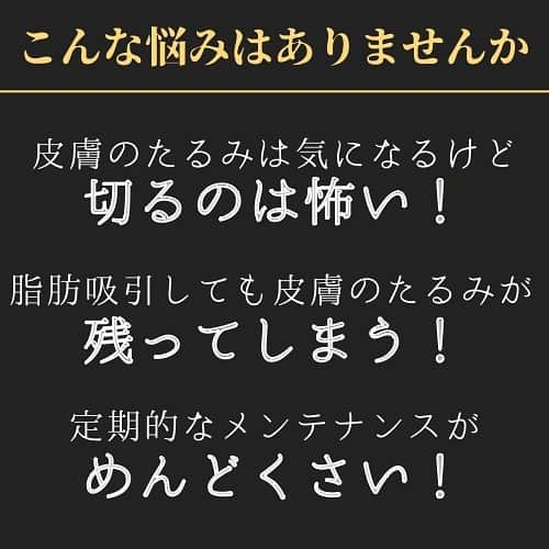 湘南美容外科 柏院さんのインスタグラム写真 - (湘南美容外科 柏院Instagram)「予約はプロフィールのリンクから　@sbc_wang  お顔やボディのたるみを革新的なRFALテクノロジー（特許取得のRF Assisted LIPOLYSIS）を使用したラジオ波で強力に引き締める最新治療です。 カニューレ（針）を皮膚へ直接挿入し、皮膚の内側・外側両面からアプローチすることで効果的にフェイスタイト・ボディタイトを実現します。  <フェイスタイト> 顔 フェイスタイトとして使用する場合は、メスによる切開が必要ないため、フェイスリフトのように切開をしてたるんだ皮膚を除去する治療と異なり、施術後の傷跡が針穴程度で目立ちにくいというメリットがあります。日常生活への影響を大きく減らすことが可能です。  <ボディタイト> 体 ボディタイトとして使用する場合は、脂肪吸引などの併用でより効果を発揮します。身体の輪郭がきれいになることで若々しいボディラインを得ることが可能です。また、皮膚の内側から刺激することでコラーゲンの生成を促し、よりハリのある身体を実現します。  施術名：エンブレイスRF 施術の説明：通常脂肪組織を溶かす温度よりも高い温度で皮膚のたるみを引き締めます。 施術の副作用（リスク）：施術部周辺の麻痺や、しびれが生じることがありますが、ほとんどの場合3～12か月程度で回復します。＼nその他、血腫・感染（化膿）・皮膚の色素沈着・傷痕のもり上がり・凹み ・色素沈着・施術部の筋肉の損傷などを生じることがあります。 施術の価格：176,360円  ご予約はプロフィールのリンクから✨ @sbc_wang  もしくはお電話でお待ちしております！ 「Dr.わんのインスタをみた」とお伝えください。  —————————————— ☀️湘南美容クリニック柏院☀️ JR常磐線柏駅　南口より徒歩3分🚶‍♂️ Day Oneタワー2階　診療期間10:00-19:00 ☎︎ 0120-489-750 ——————————————  #湘南美容クリニック #SBC #湘南美容クリニック柏院 #美容外科 #美容好きな人と繋がりたい #美容医療 #美容外科医 #湘南美容外科柏院  #脂肪吸引 #エンブレイス #エンブレイスrf #糸リフト #小顔 #たるみ #たるみ改善  #引き締め #引き締めボディ」11月26日 21時49分 - sbc_kashiwa