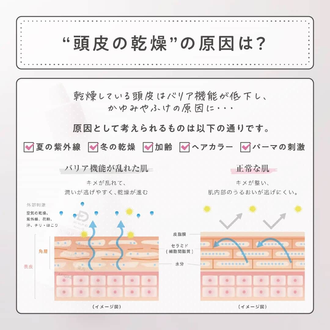 スカルプDボーテさんのインスタグラム写真 - (スカルプDボーテInstagram)「あなたも当てはまるかも？！ 頭皮の乾燥...原因を知って対策を始めよう  寒くなるにつれて、頭皮の乾燥が気になる...🌀 という方もいるのではないでしょうか？ 今回は、これからの季節にぴったりなアイテムをご紹介します！  〈こんなお悩みありませんか？〉 ✔️頭皮のフケ・かゆみが気になる ✔️頭皮のかさ月つっぱりを感じる ✔️気がつくと頭をかいてしまう  これらは頭皮の乾燥サインです🥶  〈頭皮の乾燥の原因は？〉 ✔️夏の紫外線 ✔️冬の乾燥 ✔️加齢 ✔️ヘアカラー ✔️パーマの刺激  〈頭皮にも保湿美容液がおすすめ◎〉 勇心酒造とアンファーが共同開発した 「スカルプD　ボーテ＜薬用＞頭皮保湿美容液」  コメ由来の成分（ライスパワーエキス®︎No.11）で頭皮乾燥にお別れ！！ 乾燥が気になる部分を中心に朝・夜の使用がおすすめです。  朝：スタイリング前 夜：ドライヤー後  ※育毛剤を使用している方は、育毛剤の前にお使いください。  〈使い方〉 1.頭皮が見えるように髪をかき分ける。  2.ノズルの先を頭皮に軽くあて適量 （頭頂部、側頭部、後頭部と分けて各部位3～5滴程度）を塗布。  3.指の腹で良くなじませ、頭皮に行きわたらせます。  乾燥が気になる秋🍂 お肌と同じように頭皮もしっかり保湿し、乾燥対策をしましょう✨  最後までご覧いただきありがとうございます❤︎  スカルプD ボーテでは、 女性のためのヘアケアに関する情報をお届けしています✨  @scalpdbeaute からフォローして、ぜひチェックしてみてくださいね。  商品のレビュー、感想は　#スカルプdボーテ でタグ付けしてお知らせしてね❤︎ 公式アカウントで取り上げるかも…！？  #おとなの髪のお悩みさん #アンファー #スカルプdボーテ #スカルプdボーテナチュラスター #スカルプD #ヘアケア #頭皮マッサージ #頭皮 #スカルプケア #ヘッドスパ #髪の悩み #ヘアケアグッズ #ヘアケア商品 #頭皮ケア #髪 #ツヤ髪 #シャンプー #シャンプーマニア #トリートメント #美容液 #乾燥 #乾燥対策 #頭皮の乾燥 #頭皮美容液 #保湿 #頭皮保湿美容液」11月27日 19時00分 - scalpdbeaute