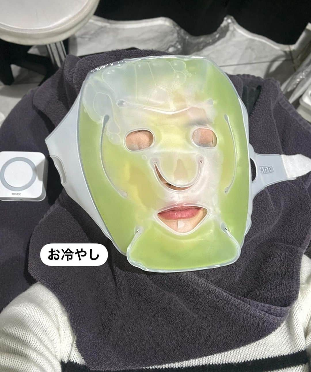 都築青空さんのインスタグラム写真 - (都築青空Instagram)「YAGBEAUTYCLINICで エクソソーム注射(水光注射)を受けました！ @yagbeauty_official  @yagbeautyclinic_shibuya  この写真ノーファンデだよ？！ 日焼け止めだけ！  エクソソームは、肌細胞を活性化させ、 肌のターンオーバーを正常に整えることで、 乾燥肌や敏感肌、にきびなど肌トラブルの改善や エイジングケアに効果が期待できる 今注目の薬剤💗  1週間ほどで内出血が引いていって みるみるうちにお肌の内側から ペカーーーンて光が発光するかんじ！！ 一回でだいぶ肌質かわって めちゃくちゃよくてまた受けたい😭😭  あおぞらのInstagramを見たで ご新規様 通常価格55,000円が50%off 既存のお客様は30%offで受けられます！ ※針麻酔代 (希望する方)別途8,800円  #YAGBEAUTY #エクソソーム水光注射 #美肌 #アンチエイジング #エクソソーム  #水光注射  #毛穴 #ニキビケア」11月27日 19時24分 - aozora723