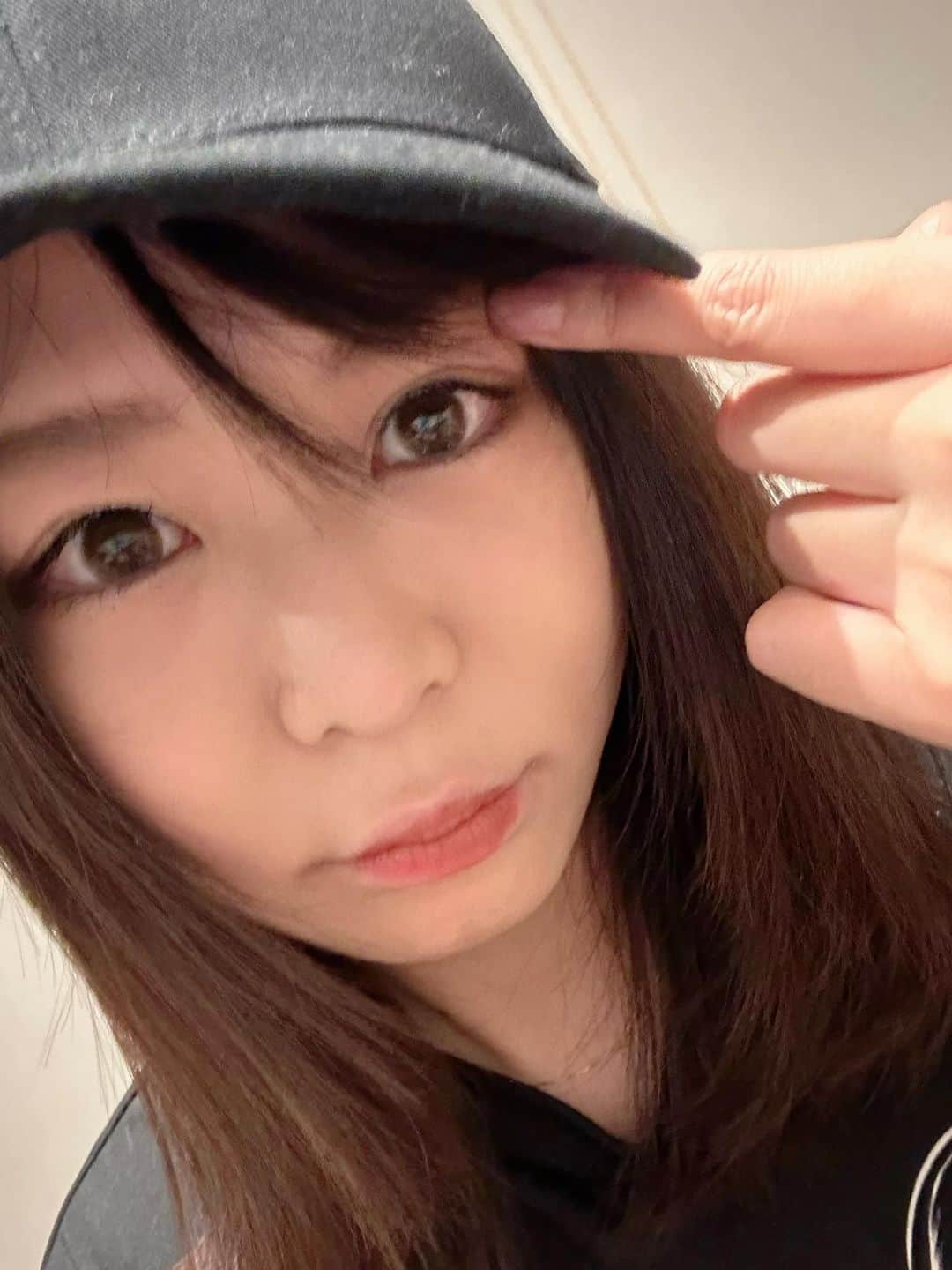 小野さゆりのインスタグラム：「涙腺腫瘍の病理検査の結果、 臓器の腫大や結節・肥厚性病変などを認める原因不明の病気 IgG4関連疾患の難病だと診断がでました( ﾟωﾟ；) ステロイドによる長期管理が必要だそう。 全身に広がってるかもだから、PET検査（3万円）をまずはする。怒涛の1年すぎる(´ω`；)   #涙腺腫瘍　#IgG4関連疾患」