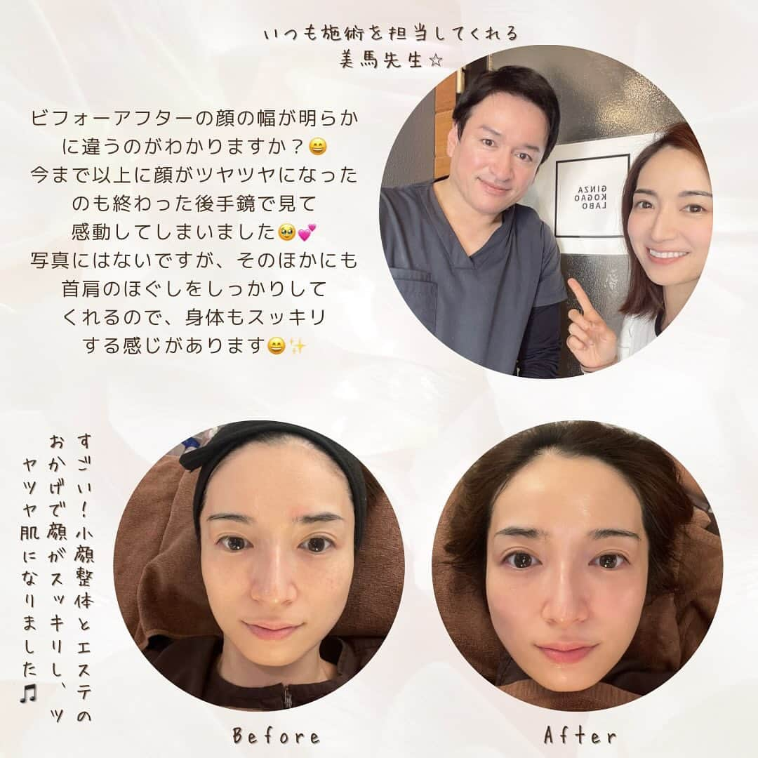 Mayuko Watanabe 渡辺真由子さんのインスタグラム写真 - (Mayuko Watanabe 渡辺真由子Instagram)「巣鴨駅にある @ginza_kogao_labo に行ってきました♡ いつも美馬先生の上手な施術で肌が生き返ります🥹💕 詳しくは投稿を見て下さい🎵 #銀座小顔ラボ #ginzakogaolabo #小顔矯正 #巣鴨  #小顔 #小顔マッサージ   #コスメコンシェルジュ #コスメコンシェルジュアンバサダー #美容好き #美容すきな人と繋がりたい#美肌になりたい人と繋がりたい   #ママコーデ #ママファッション #男の子ママ #男の子兄弟 #男の子兄弟ママ #カジュアルコーデ」11月29日 15時11分 - watanabe_mayuko