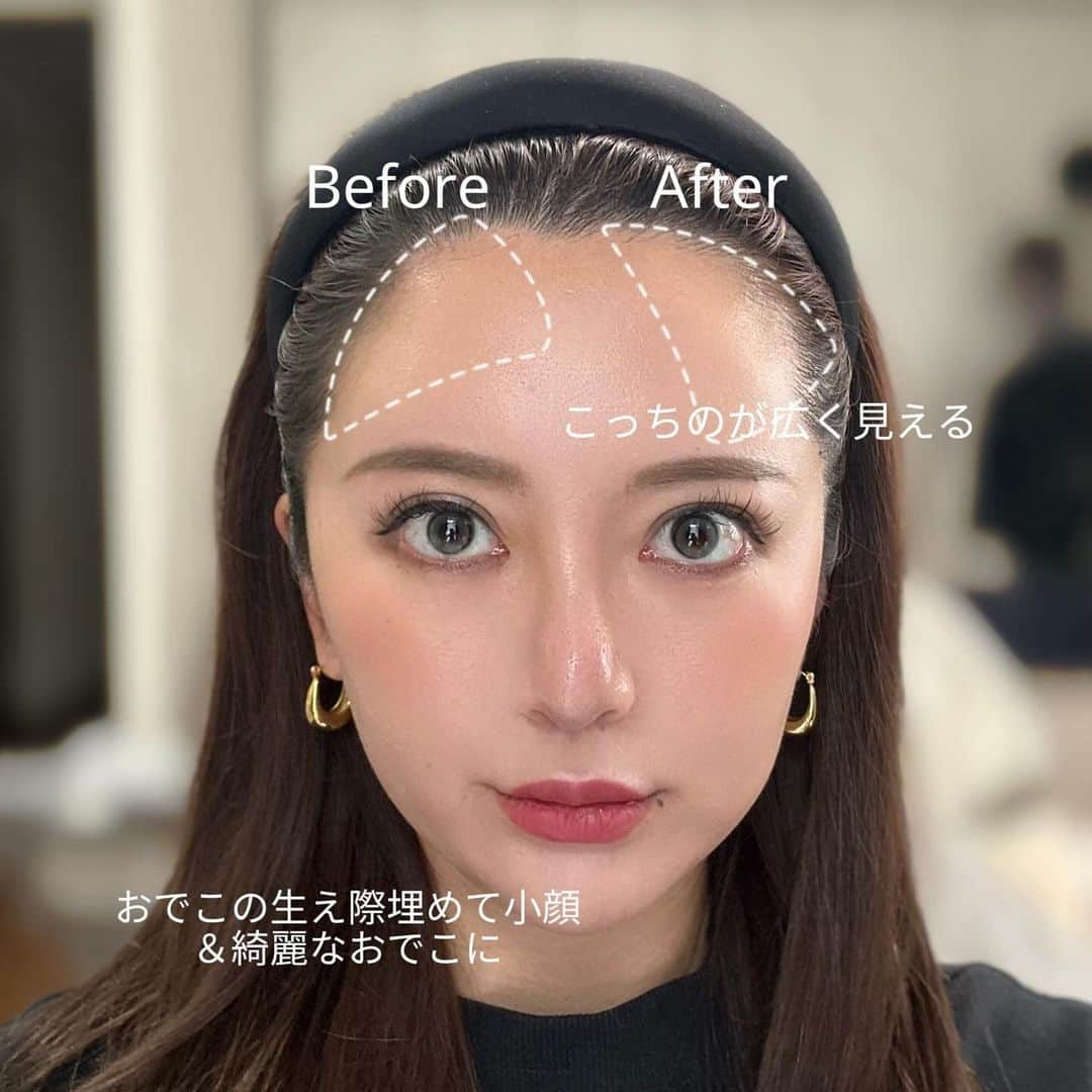 丸山慧子さんのインスタグラム写真 - (丸山慧子Instagram)「. 生え際がどんどん際どくなってきて アートメイクをするか悩んだけど アートメイクだと 髪色をコロコロ変える私には不向き という事で今回フジコのデコシャドウを✨  正面見て左側は埋めてて 右側埋めてないんだけど差がすごく無い？😳  これやるかやらないかで 相当変わるし 前髪を下ろしてる時は つむじにポンポン乗せてるよ🤍  ※いつもとカラコンもメイクも違うから めっちゃきつめです。笑  #コンプレックス解消メイク #fujiko  #小顔に見える #小顔メイク」11月29日 18時10分 - keiko.423