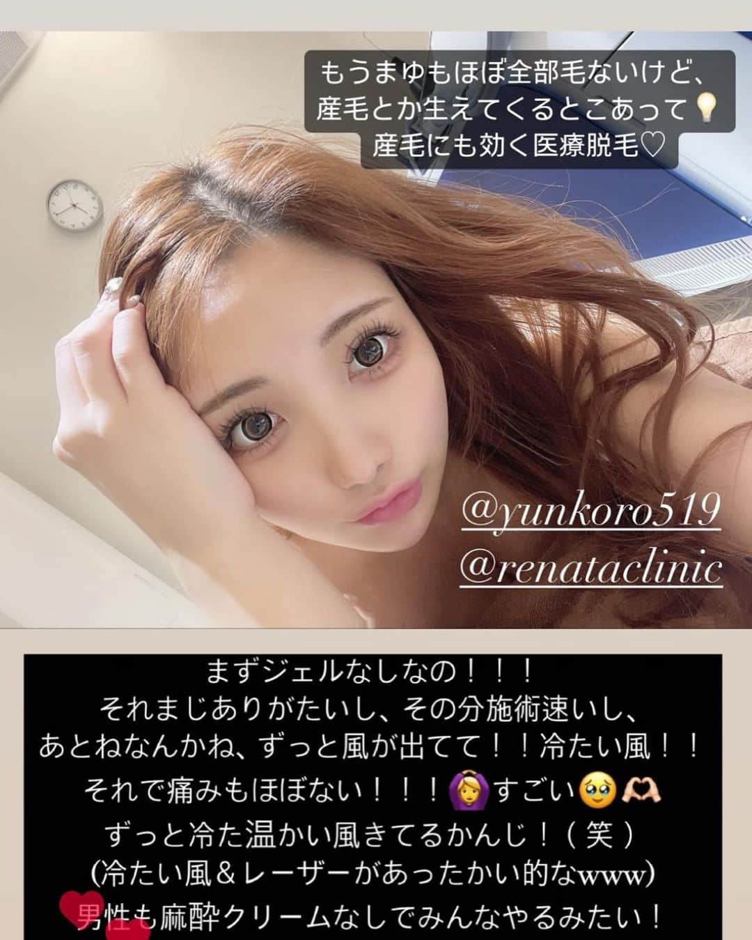 まゆぴちゅーさんのインスタグラム写真 - (まゆぴちゅーInstagram)「最新＆最高な医療脱毛🩶🤍  ゆんころさん @yunkoro519 のクリニックの @renataclinic でこの前医療脱毛やってきたの♡  いやもうね！！！  最新機器すぎて感動で🥺🤍✨✨✨  まじ全く痛くないのにもびっくりだし、 ジェル使わずなんかずっと風がでてて あったかいレーザーがあたってるかんじ？笑  とにかく最新すぎて感動！！！！！  まゆもうほぼ全身脱毛終わってるけど やっぱまだ産毛とか、気になるところとか 生えてきたりするから、 ここの医療脱毛で完璧に綺麗にしよとおもた🙊✨  毛が生えてる人でも痛みが少ないから、 男性にも人気みたい！！！✨  脱毛悩んでる方はぜひ行ってみて☺️🩷  ゆんころさんがおすすめしてた通り ほんとにすごかった…！！！🥹✨✨  今の所まだ一回だけど 産毛とか毛がまだ生えてきちゃうとこも 生えるの遅いというか生えてこなくて 効果感じてるしまじすごいです🤤🤍✨  他にもいろんな施術やってて、 お気に入りのクリニックです☺️💕  ▶︎ @renataclinic (表参道院)  ちなみにこの うさちゃんサンタコスプレも、 以前撮影した @malymoon1991 の🎅🏻❤️ . . . #pr #renataclinic #表参道クリニック #クリニック #医療脱毛 #メンズ脱毛 #サンタコス #サンタコスプレ #サンタコス撮影 #スタジオ撮影 #malymoon #malymoon撮影会 #コスプレ撮影 #コスプレ女子」11月30日 19時38分 - mayu_03pichu