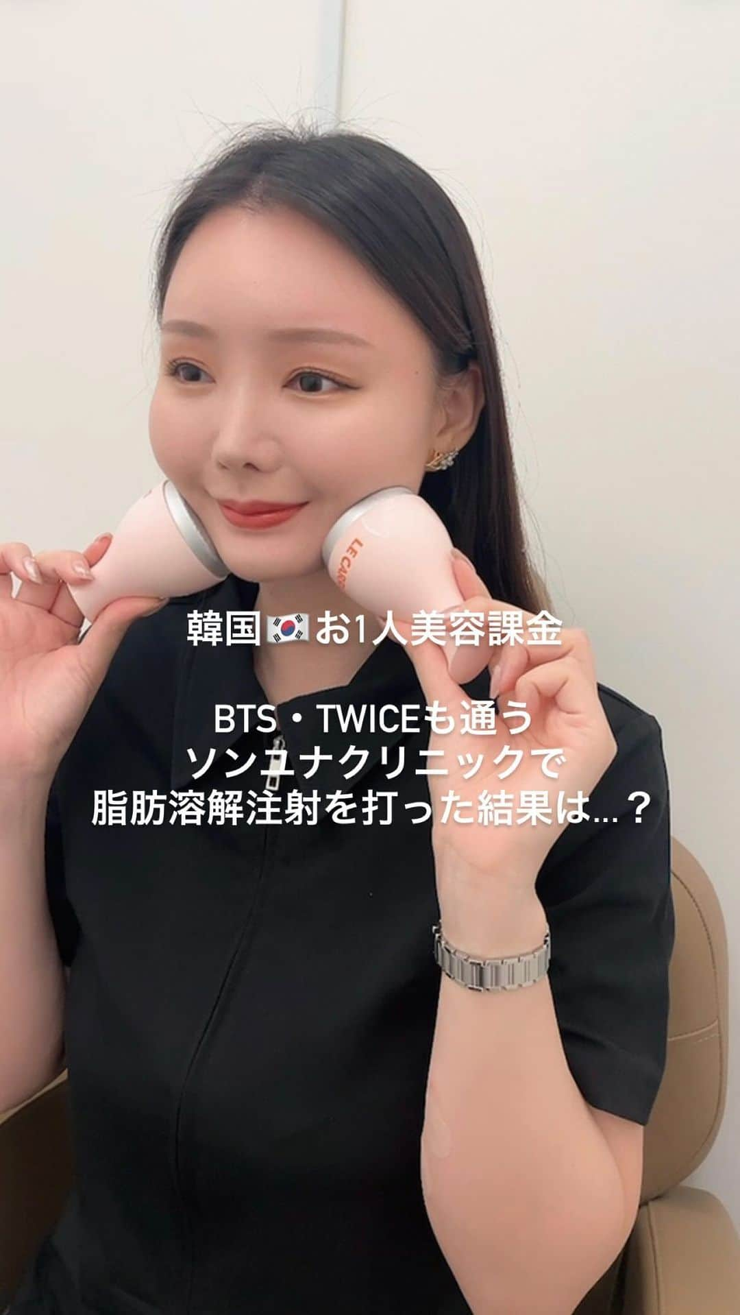 ゆうりちゃんのインスタグラム：「やって良かった！ ソンユナクリニック🇰🇷レポ❤️  今回、キャット注射という 脂肪溶解注射を打ちました✨  これは他の脂肪溶解注射と違って 半永久的なんです！  1ヶ月後くらいから お肉🍖のあった部分がスッキリし始めて  ダイエットはしてないのに 周りからは「痩せた！痩せた」が 止まらない🥹💕  (なんならちょっと太ったときも 痩せた！って言われてた🤣🤣)  キャット注射💉した事を みーーーんなに教えてあげたよ✨  韓国🇰🇷行った時にする！って お友達も数名いるよ💕 ナチュラルに顔の脂肪を減らしたいなら @sonyouna.jpofficial  へ😚🎯  #韓国#韓国美容#韓国美容外科#韓国美容情報#脂肪溶解注射#韓国旅行#痩せたい」