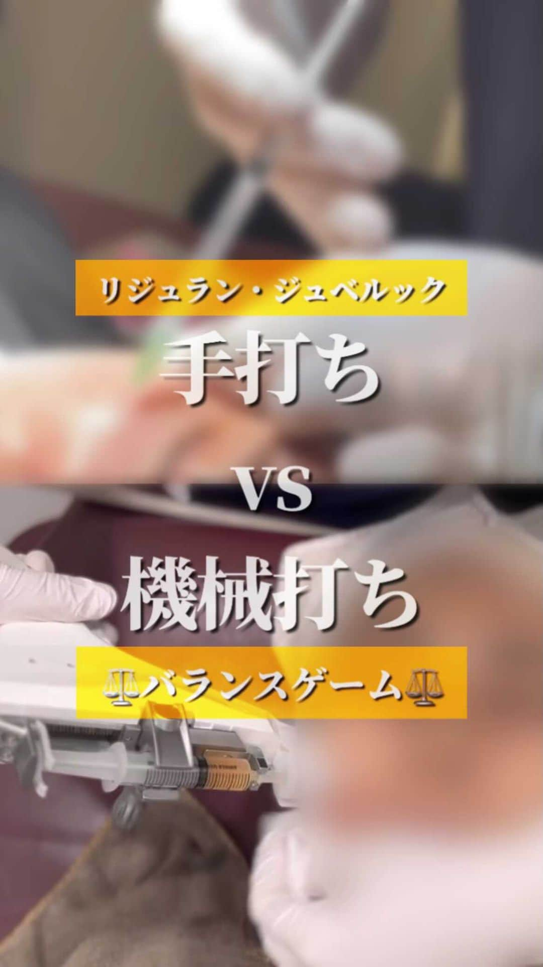 オラクル美容皮膚科東京新宿院のインスタグラム：「～手打ちVS機械打ち～ ⁡ リジュランとジュベルックの手打ちがスタート！ ⁡ ✅違いは何？ ✅どっちがいいの？ ⁡ バランスゲーム⚖️ ⁡ +‥‥‥‥‥‥‥‥‥‥‥+ ⁡ 【リジュラン機械打ち料金】 リジュランヒーラー　1.5㏄ 35,200円 高濃度リジュランピュア　2cc 52,800円 ⁡ 【リジュラン手打ち料金】 ・1.5CC  44,000円（目の下） ・4.0CC  88,000円（両頬または首） ・5.5CC  110,000円（全顔） ・8.0CC  150,000円（全顔＋首） 参考：機械打ち　全顔2CC 52,800円（税込） ※別途、麻酔代2,200円 ⁡  +‥‥‥‥‥‥‥‥‥‥‥+ ⁡ 【ジュベルック機械打ち料金】 ・3cc　52,800円 ⁡ 【ジュベルック手打ち料金】 ・1CC  26,500円（局所部位：凹みorニキビ跡or鼻） ・2CC  51,000円（両頬） ・3CC  77,000円（全顔または首） ・6CC  149,000円（全顔＋首） 参考：機械打ち　全顔3CC 52,800円（税込） ※別途、麻酔代2,200円 ⁡ ⁡ ⁡ ⁡ #水光注射 #韓国美容 #美容皮膚科 #ジュベルック　#ジュベルック注射 #juvelook #リジュラン　#リジュラン注射 #水光肌 #ハリ #艶 #艶肌 #肌再生 #コラーゲン #美容 #韓国好きな人と繋がりたい #オラクル美容皮膚科」