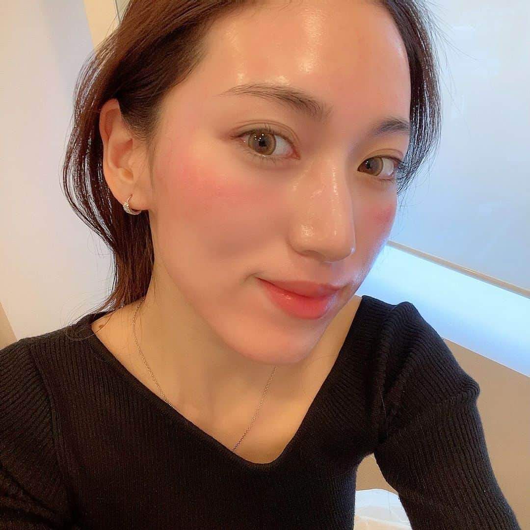 岩下真奈さんのインスタグラム写真 - (岩下真奈Instagram)「2023.12.01 #beauty 🧖‍♀️ * 📍General Clinic ( @generalclinic_official ) . . 更なる美肌をめざして…❕ 人生初🤍ダーマペン施術して頂いてきました🫧 . ダーマペンとは🔍 超極細の針を肌に刺して一時的に極小の穴を開け、 皮膚の自然治癒力を引き出す美容施術🪡 . コラーゲン・エラスチンの生成促進やターンオーバーの改善効果があるから、 気になるニキビ跡や毛穴の開きの解消や ハリやツヤ感アップが期待できるってワケ👊🏻✨️ . . 施術前にしっかり麻酔を塗るので痛みはまだマシ…🤏🏻 . 皮膚が薄いところ等は痛かったり、 人によって個人差はあるけど、対価がでかいので耐え🎈 . 施術直後は麻酔と痛みで少し違和感くらい。 あとは顔の皮もその日のうちからポロポロ落ちてくるからマスクは必須😷 赤みは私は3日くらいで引いたかな〜、 そんながっつりダウンタイム！って感じじゃなかった👌´- . . そして今、施術から1ヶ月が経過しました🪞💞 [写真5枚目現状ノーマル外カメ撮影📸！] . 1番気になっていた毛穴の開き、 もうほぼゼロくらい気にならなくなった🥹🥹✨️ . ニキビ跡やニキビのできやすいところとか ベースの肌質改善はまだ回数重ねないと気になるけど、 毛穴のキメ整ったのが大満足すぎて💮💯 . ハリツヤもかなりアップして、ファンデまで塗ったら 仕上がりちゅるんって感じになって最高🫶🏻‪‪❤︎‬ . 初めてで緊張してたけどやって良かった💡 . . General Clinicさんは説明も施術も丁寧で良かったので とってもオススメです🪄是非チェックしてみてね!! . . . #PR @dr.natsukiogawa #ジェネラルクリニック #美容医療 #美肌 #美容クリニック六本木 #ツヤ肌 #ニキビ跡 #肌荒れ  #model #fashion #makeup #ダーマペン #肌質改善 #美容医療 #美容垢 #美容マニア #美容オタク #毛穴ケア #ニキビ跡 #フリーランス #モデル #ファッションモデル #撮影会 #広告モデル #ファッション #おしゃれさんと繋がりたい #カフェ好きな人と繋がりたい #邦ロック好きな人と繋がりたい #美容好きな人と繋がりたい」12月1日 19時03分 - mana_mdleam