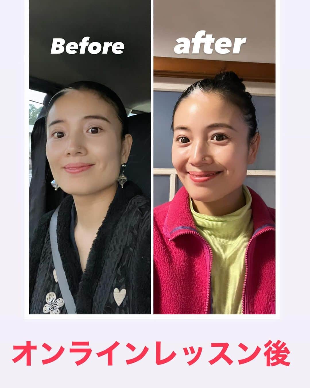 屬美於のインスタグラム：「これ本当に冗談じゃないんです  現に、最近顔が変わってきたね！って言われるんです！骨格🦴かえて@Mioyoga styleメソッドが最強なんです。  オンラインレッスンのメンバーとコツコツ筋肉移動をつづけてる成果❤️❤️☺️😍 小顔になって私の気になるエラがまるくなって顔が上がってる！最高🤣❤️眉毛も目尻も小鼻も上がってるの分かりますか？  たのしいししんどくないし、かわいくなれるしパフォーマンスあがる！  本気で変わりたい方だけでいいんです。 オンラインレッスン生募集中🫶☺️」