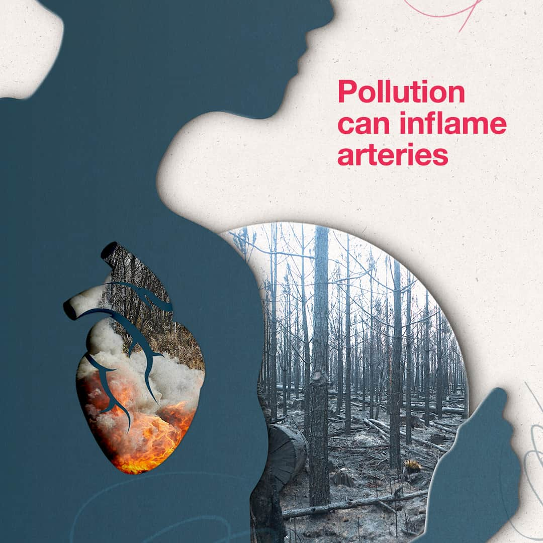 バイエルさんのインスタグラム写真 - (バイエルInstagram)「Climate change is not only affecting our environment, it poses a significant risk to our cardiovascular health.  We are already seeing the impacts from extreme weather and pollution, and without action, projections show a much higher toll in the years to come.  For the first time, this year’s COP — the @unitednations' Climate Convention — will devote a full day to the impacts of climate change on our health.   Everyone deserves access to the heart health solutions they need to thrive, and at #COP28, we are focused on working toward solutions that converge climate action and “health for all” to build healthy, resilient communities.   #HealthyPlanetHealthyBody #ClimateChange #HeartHealth #ClimateAction」12月2日 14時06分 - bayerofficial