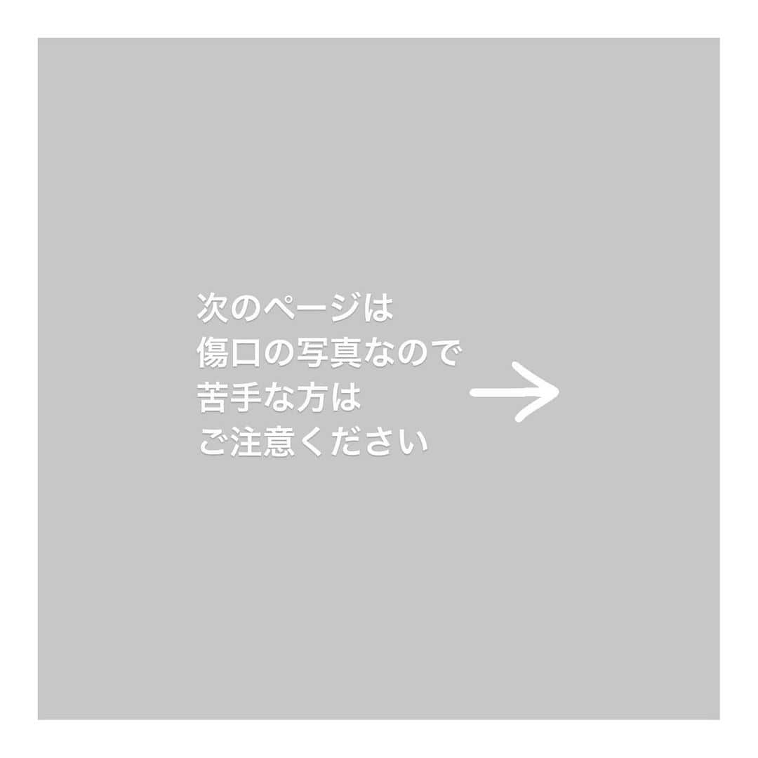 こむぎさんのインスタグラム写真 - (こむぎInstagram)「* 猫エイズしまくん＆猫白血病ポンちゃんの2023年の収支報告です🙇🏻② (この投稿の7枚目の写真にしまくんのお鼻の様子を載せています🙇🏻傷口など苦手な方はご注意ください🙏🏻)  2023年に頂戴したご寄付やウェブショップの売上など 収入合計が393,011円…⑤  収入合計393,011円 支出合計548,685円 収入-支出はマイナス155,674円となりました。 (10月開催のひみつのねこ展は別で計算をして多頭崩壊とどうぶつ基金へ寄付をしています。詳細は11/18投稿済)  個別に保護している猫たちについては、普段お金のご寄付を募ることはしていないのですが、今年はしまくんの抜歯手術があり(残痕している歯の根っこを取る大掛かりな手術でした)、その手術費用について今年の2月にご寄付を募らせていただいたのと、ありがたいことに知り合いの作家さんやインスタを見て個人的にご連絡くださった方などからのご寄付も多くありましたので、2023年の収支のまとめ報告をさせていただきました。 2月の手術の時の詳細は2/6にインスタに投稿させていただいております🙇🏻  保護活動はボランティアとしてやっているので費用が黒字になることは毎年ないのですが、今年はそれでもなんとか皆様のご協力の元、支出をマイナス15万円程度に抑えられました😭  直接のご寄付以外にも、フードなど支援物資をご協力くださった方、こむぎねこウェブショップで商品をお求めくださった方、ねこ休み展でザビエル首輪をお求めくださった方(まいさんいつも置かせてもらって本当にありがとう😭)、インスタのライブ配信でバッヂをお送りくださった方、たくさんのご協力本当に感謝致します。  保護活動にかかる費用としましては、細かなところをあげるとガソリン代や高速代、光熱費、あとザビエル首輪を作るための材料費や工賃などありますが、載せるとキリがないので支出として載せているのはカード明細などで金額がハッキリとわかる範囲にしております🙇🏻🙇🏻  しまくんのお鼻に関しては、11月頃から段々と赤い傷が広がり始めました。 昨年も似た感じの物が出来た時にステロイドを塗って治ったので、今年も同じように対応していたのですが、私がカラーをつけるタイミングが遅くて段々と大きくなってしまい😭 病院でも扁平上皮癌かもと最初は先生からもお話しがありましたが、今日診ていただいた感じでは天疱瘡の可能性が高いとのことだったので、引き続きステロイド(飲み薬)を続けて様子を見ることなりました。  扁平上皮癌にしても天疱瘡にしても確定診断をするには軽い鎮静をかけてお鼻の細胞を取って生検をする感じになるので、どうしても鎮静をかけることに抵抗があるのと(しまくん手術の時は本当に危なかったので…)、お鼻の傷が大きくなってしまうのが心配だったので、まずは簡易検査(細胞診)からしましたがそちらでは炎症反応しかでなくて…。 生検をするタイミングを見計らっていた中、癌ではなくて天疱瘡の可能性が高いと仰っていただき、だいぶホッとしました😭 青井さんからも別の先生にもしまくんのお鼻の写真を見ていただき同じ意見だったそうでより安心しました！😭 天疱瘡は直接命に関わる病気ではないけれど、人間でも治療しないと死に至る慢性疾患と言われていて、しまくんも治るまでにはもう少し時間がかかりそうなのと、再発をしやすいそうなので、日頃から気をつけて見ていることと、カラーを早めにつけること、部屋の湿度管理も今後もずっと必要になりそうです。 今はSwitch Botの加湿器でお部屋の湿度管理もしています。 最近は好酸球性肉芽腫のシコリもほとんどなくなっていたので、それで余計に癌なのかもと心配になりましたが、シコリが出来るのと天疱瘡が出来るのとはまた別物なんだなぁと、免疫の病気でも色々違うのだなと勉強になりました🥲  長くなりましたが、しまくんのストーリーズを見てご心配くださった皆様本当にありがとうございます🙇🏻 しまくんもポンちゃんも保護時に比べたら今はだいぶ体調は落ち着いていますので、里親さんも引き続き募集中です🙏🏻✨ 頑張っている子達こそ、幸せ掴んでほしいなと思っています☺️ 病気があっても、何か抱えていても、「うちにおいで」と言ってくださる素敵なご家族との出会いがありますように…🙏🏻🙏🏻  2024年も引き続きどうぞ宜しくお願いいたします🙇🏻🙇🏻」12月18日 23時00分 - tomochunba