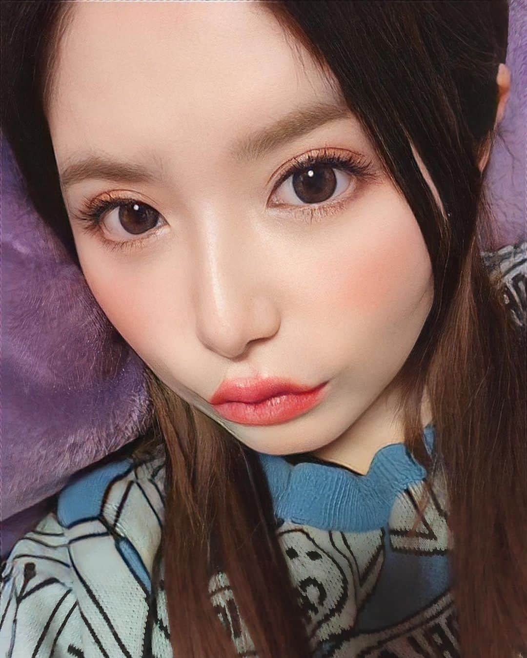 栗林里莉さんのインスタグラム写真 - (栗林里莉Instagram)「♡ 東京中央美容外科秋葉原院さん(@tcb_akihabara )でTCB式1dayクイックアイの施術をして頂いて1週間経ちました👁️  痛みは全くなく、腫れもどんどんなくなってきてすごく順調です✨  これからもっと馴染んでいくみたいなので楽しみです😊  また経過報告するねー🙋‍♀️  #二重 #二重整形 #二重埋没 #TCB式1dayクイックアイ #東京中央美容外科 #東京 #秋葉原 #PR」12月8日 15時12分 - riri_kuribayashi_official