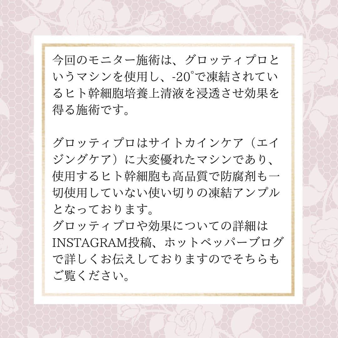 黒崎えり子さんのインスタグラム写真 - (黒崎えり子Instagram)「限定モニター募集中✨エイジングケアをされたい方には特にお勧めです！  【グロッティプロ】マシンとヒト幹細胞培養上清液を使った施術です。  《モニター募集要項》  ・全10回 コース　¥220,000→半額　¥110,000  ・全10回を期限内に受けれる方（16週間以内）  ・ビフォーアフターの撮影にご協力頂き、サロン内、及びSNSへの掲載にご同意いただける方 （ただしVIOについてはサロン内の資料としての取り扱いのみでございます。） また全てが部位撮影の為、個人の特定はありません）  ・フェム（VIO）のコースは、毛のある方にはワックス脱毛を無料で施術いたします。  ご興味がお有りの方はぜひ一度お問い合わせください。 お問い合わせ方法はインスタグラムDM、公式LINE、Eメール、お電話何でもOKです。 ご質問だけでもお気軽にお問い合わせください😊  グロッティプロ、ヒト幹細胞培養上清液、施術内容、効果等の詳細はInstagram投稿やホットペッパーブログで詳しく掲載しております。  Instagramではerii salonのハイライト〈グロッティプロ〉の丸いアイコンをタップすると、関連投稿が見れます！  皆様のお問い合わせをお待ちしております！  ....... ....... ....... ....... ....... サロン住所  erii FEMCARE&Skincare-WAX  東京都渋谷区神宮前4-18-9 ボヌール表参道101 ....... ....... ....... ....... .......  ご予約▶︎ ホットペッパービューティー 検索🔎 『erii wax 』『エリィワックス』  ……………♡………….   完全予約制 プライバシー重視　個室 丁寧なカウンセリング  ……………♡………….   エリィサロン　@eriisalon  黒崎えり子　@erikokurosaki322  エリコネイル  @erikonail  ネイルサロン  @erikonail.omotesando コスメ　@erii.professional   #ワックス脱毛　#黒崎えり子　#ワックストリートメント　#エリィワックストリートメント　#エリィ　#フェムケア　#表参道　#アイブロウ　#眉毛　#ハンドクリーム　#くすみ改善　#エステサロン　#肌質改善　#個室　#完全個室 #美肌　#顔脱毛　#フェイシャル #エステ　#生理不順　#更年期　#VIO  #フェムケアマッサージ　#体質改善　#美白　#毛穴ケア　#ピーリング #ワックス」12月9日 17時34分 - erikonail