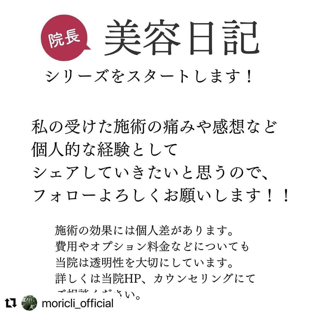 宋美玄さんのインスタグラム写真 - (宋美玄Instagram)「見た目を構う余裕がなく、野ざらしにしてきた私があるきっかけで美容医療を取り入れ、めっちゃ調子良くてハッピーになってることを日記に。 懐かしの、伝説の、すっぴんアエラ写真も。  #リポスト @moricli_official  ・・・ 当院が皮膚科、美容皮膚科をスタートして３ヶ月あまり。「院長美容日記」の連載をスタートします。 第1回目の今回は、当クリニックが美容皮膚科をはじめた理由から↓↓↓  こんにちは。丸の内の森レディースクリニックの宋です。 当院で美容皮膚科を開院し、4ヶ月が経過しました。私も早速あれこれ施術を受けたりしているので、セキララ美容レポートを、記録をかねて書いてみたいと思います。  40歳になったころ、ネットのコラムに「美人に生まれなくて良かった」という記事を書いたのですが、当時、結構な反響をいただきました。内容は「外見の美しさをアイデンティティの一つとして生きてきた人で、アラフォーになって若い頃の自分と比べてしまい、落ち込んだり、やりすぎなまでに美容医療に頼ったりする人がいるので、最初から外見がアイデンティティに関係なくて良かった」というものでした。  実際のところ、アラフォーくらいから肌のくすみ、シミ、たるみなどが気になり始める人は多いと思います。同世代の友人で、より手厚いケアをし始める人も増えました。私はその頃、2回の高齢出産により子育てが大変すぎた時期で、自分のことには全く構えず、美容院も年に1~2回しか行けないくらいでした。  ある時、仕事の合間に受けた週刊誌の取材で、写真撮影があると聞いていたのに全くメイクをする余裕がないまま取材に臨み、赤みもくすみもそのまま雑誌に載るという伝説を作ってしまいました。ママ友にも「あんた、さすがにあれはダメだよ」と言われてしまいました。  思わず「私は、見た目を売りにメディアに出ているんじゃないから」と言い訳しましたが、写真付きの取材にメイクをつけてもらうとプラス1時間くらいかかってしまうので、未就学児を育てながら馬車馬のように働き、本業以外にもインプットとアウトプットに追われていた私にはその1時間は捻出できなかったのです。実際、似たようなことが何度もあり、完璧に身繕いされた美しいタレントさんと、スッピンで髪もセットしていないまま一緒のページに載ったこともしばしば・・。 ある意味無敵？でした。  その後、コロナ禍がやってきて、毎日マスク生活。イベントも取材もオンラインがほとんどになって、画像処理でお肌がツヤツヤに見える機能の力も借りて、しばらく自分の中でもますます見た目を気にする機会は減りました。  そんな中、転換点となる出来事がありました。今年の春にテレビに出た時に、プロの方にメークしてもらったのですが、左頬の肝斑に6回コンシーラーを塗られたのです。長いマスク生活で摩擦のせいもあるのか、両頬の肝斑がだんだん濃くなっていくのは感じていました。  「やっぱり、目立つよな・・ 　この肝斑は公共の電波に乗せられないレベルなのか・・」  そんなわけで逃げずに直視せざるを得なくなり、皮膚科専門医の先生に相談。 まずは肝斑を薄くすることで、他の美容にチャレンジできる肌を作ろうということで、トラネキサム酸とビタミンCとビタミンEの内服を始めました。  これが美容日記の始まりです。もうかれこれ８ヶ月になりますが、毎日内服を続けている甲斐もあって、肝斑はかなり薄くなりました。 （もちろん内服以外にも対策を行っていますので追々お伝えします。。）  実は、私にはもともとアトピー性皮膚炎があり、敏感肌でほとんどの化粧品が使えません。メディアの仕事でメイクをしてもらう機会があると、その後数日はアトピー性皮膚炎用の軟膏をたっぷり塗って休めていないとダメなくらい、肌が弱いのです。  そんな私でも、保湿とUV対策ばかりじゃなく、攻めの美容がしたい！そこから始まった壮大な美容計画。ビフォーアフターの赤裸々な写真も交えつつ、院長やスタッフが経験した美容皮膚科の施術を解説しながら、痛みやダウンタイムの状況などを解説していこうと思います。 お楽しみに。  #美容皮膚科 #施術解説　#産婦人科 #ルメッカ #ハイフ #ボトックス #トラネキサム酸 #ビタミンC #肝斑 #丸の内で美容 #丸の内オアゾ #皮膚科　#丸の内の森レディースクリニック　#丸の内　#東京駅　#敏感肌　#敏感肌美容 #院長美容日記　#肌が弱い　#美容施術 #ipl」12月11日 17時51分 - mihyonsongkobe