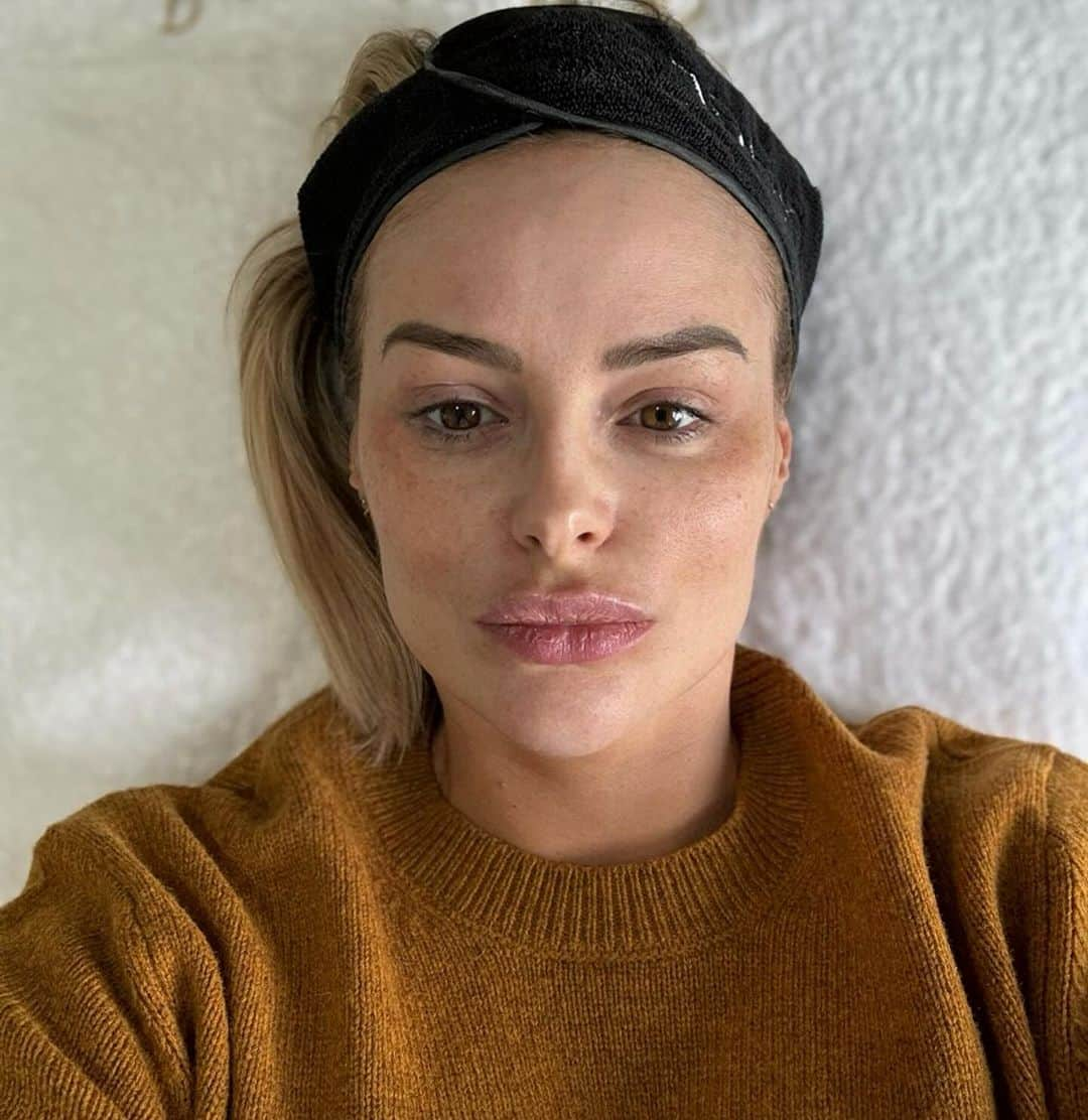 リアン・スグデンさんのインスタグラム写真 - (リアン・スグデンInstagram)「You Glow Girl!!   Much needed LPG facial @pellisandco 🫶🏽  What a dull Diana I looked before. (Pic 2). Gentle lymphatic drainage and collagen boosting, and a lovely face massage…  all pregnancy safe! Pleased for me!  Where’s the pregnancy glow attttt!?   Thank you so much! 🫶🏽✨」12月13日 2時20分 - rhiansuggers