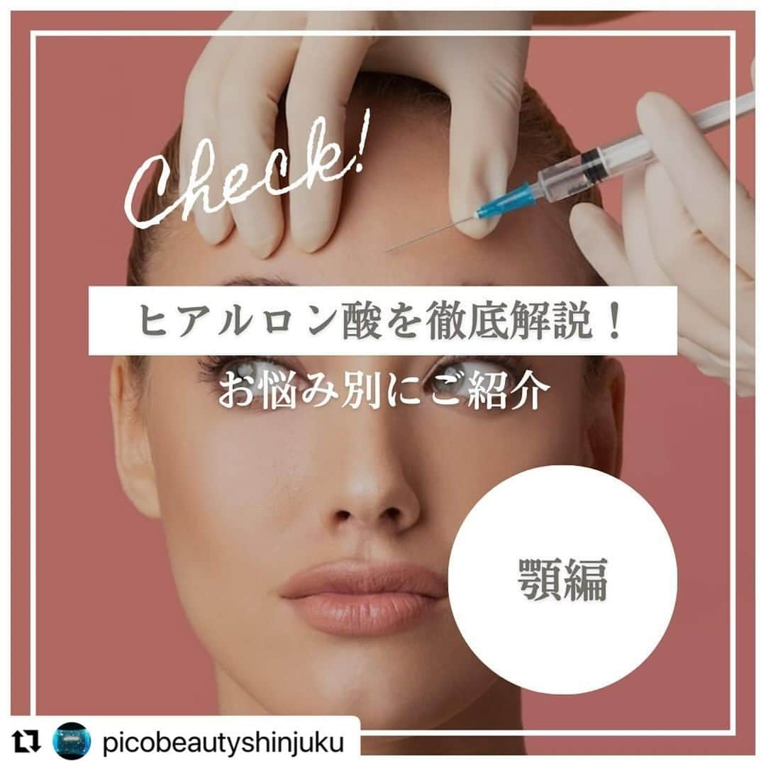 YAG BEAUTY CLINICさんのインスタグラム写真 - (YAG BEAUTY CLINICInstagram)「#Repost @picobeautyshinjuku with @use.repost ・・・ 日本人は顎がない？！ Eラインってなに？？美しい顔のバランスって？？ 顎ヒアルロン酸について解説してます🤓 是非一度当院にてご相談下さいませ💁‍♀️💜  ご予約・お問い合わせにつきましては当院までお電話お待ち致しております🙇‍♀️ 💎PICO BEAUTY CLINIC💎 〒160-0022 東京都新宿区新宿3-29-17新盛堂ビル8階 📲0120-900-253  #美容クリニック #美容外科 #美容皮膚科 #美容看護師 #picobeautyclinic #ピコビューティークリニック #ピコレーザー #新宿三丁目 #新宿 #ピコシュア #ピコトーニング #ピコフラクショナル#ピコスポット #シミ取り #シミ取り放題 #ピコシュアならピコビューティークリニック  #肌育  #アンチエイジング　#スキンケア #美白ケア #ダウンタイム #若返り #肌治療 #フェイスライン #ヒアルロン酸とは #口ごぼ #症例写真 #顎ヒアルロン酸 #ヒアルロン酸注入   @yagbeauty_official」12月13日 15時23分 - yagbeauty_official