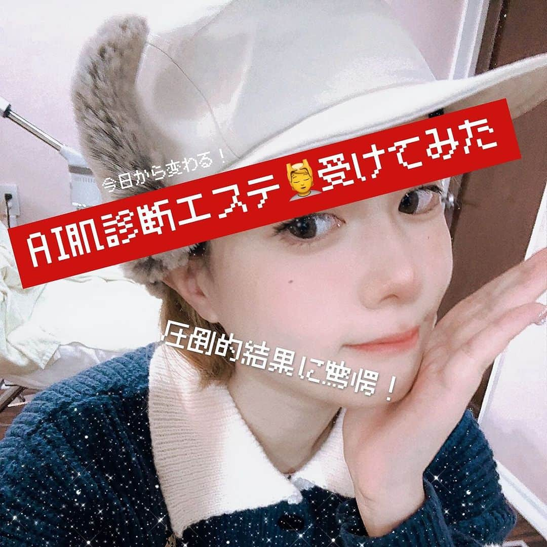 七瀬さくらさんのインスタグラム写真 - (七瀬さくらInstagram)「PR🎀AI肌診断付きのフェイシャルエステを受けてきました！✨💆  新宿西口駅🚉すぐのビルにあるエステサロン🏢  お姉さんの丁寧な接客と綺麗な店内に癒されながら施術を受けられます♪ クレンジングをして、AI肌診断をしてくれる機械に顔を突っ込み診断してもらいます。 こんなことまでわかるの！？ってくらいに全て詳細に出してくださいます。 毛穴のゲージが全く右にふれてない！すごい！毛穴なし！ 初の体験だったので、肌をめちゃくちゃ褒められて有頂天でした🤍 診断結果に合わせて、ニキビはないのですが肌の色が不均一なため（ニキビケアだけの効果ではないため）ニキビケアコースを選択。 終わった後は、綺麗な肌色にトーンアップ✨ ドライ肌なのに帰り道はぷるぷる保湿状態で帰れました❄️  お姉さんがあまりにも素敵なお話をしてくださるのでずっぅっっとお話ししてました。 めちゃくちゃ楽しかったです…笑 言われた通り、本日からしっかり保湿強化していきたいと思います…！頑張ります！  PR @luminous.shinjuku #遺伝子解析サロンLuminous #Luminous #新宿エステ #新宿フェイシャル #新宿小顔 #新宿フェイシャルエステ #新宿エステサロン」12月20日 16時08分 - 739ra