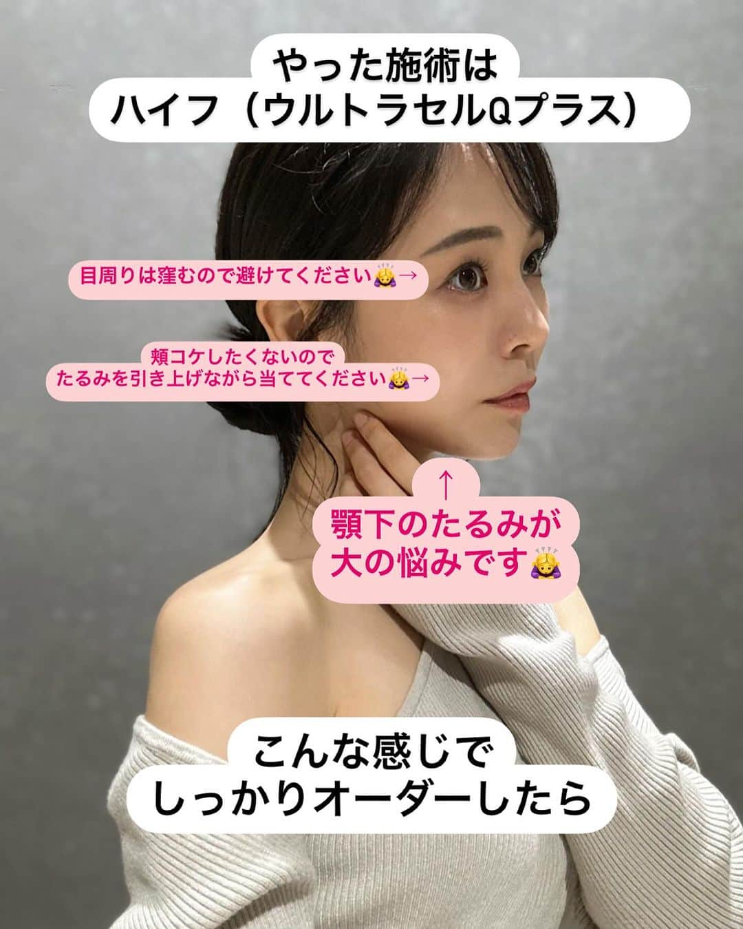 りーまるさんのインスタグラム写真 - (りーまるInstagram)「📍@juno_beauty_clinic_shinjuku ハイフしてきました〜❣️  ハイフといえば、 すこーし痛いのを想像すると思うのですが、 全く痛くなくてびっくり！！  私は 顎下、顔周り中心にやってもらいました🥰  クリニックは新宿高島屋のすぐ近く✨ 施術してくれたお姉様も優しくて、 とてもいいクリニックでした😭❤️  #PR  #AND美容外科 #AND美容外科でなりたい自分に  #美容 #美容クリニック #美容整形#美容医療 #女子力アップ #美容オタク #美容マニア #美容垢 #美容女子 #垢抜ける方法#JUNO_for_WOMEN #ATOM_for_MEN #ジュノビューティークリニック #アトムクリニック#顎下のたるみ#ハイフ東京#美容外科 ＃東京美容外科 #医療施術#新宿美容クリニック」12月28日 18時01分 - riii_maru162cm