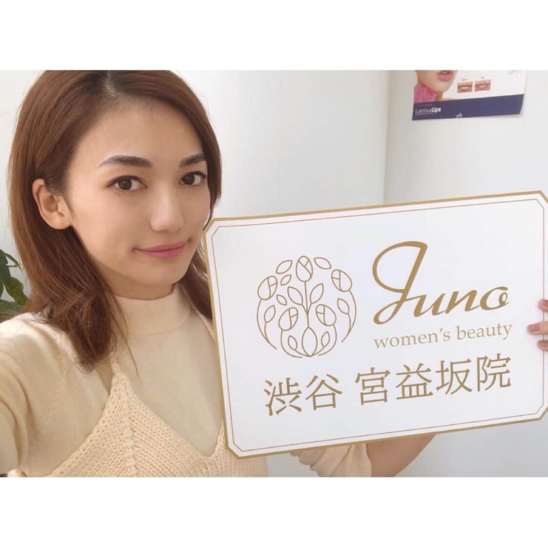 のインスタグラム：「久しぶりすぎる投稿✨﻿ 皆元気かな〜？？？﻿ ﻿ 先日#ジュノ渋谷宮益坂院 さんで﻿ 眉のアートメイクをやってもらいました❣️﻿ ﻿  @juno_womens_beauty_shibuya_m ﻿ ずーっとやりたかった眉のアートメイク！ 投稿遅くなってしまったけど数ヶ月前です！﻿ ﻿ お化粧時間が短縮できてオススメ☺️﻿ 眉があるだけでこんなに楽だとは🤣﻿ Before/Afterが違いすぎるね🤫﻿ 希望通りの形にして頂けて嬉しいです✨﻿ めちゃくちゃ気に入ってます🧡﻿ ﻿ ﻿ 興味ある方は「私の投稿を見た」と言ってアートメイクの予約&来院で、白玉注射がプレゼントになるみたいなので行ってみてね🥰﻿ ﻿ 施術直後の写真なので少し濃いめだけど、今は馴染んできてよりイイ感じ❣️ ﻿ ﻿ #アートメイク ﻿ #医療アートメイク ﻿ #アートメイク眉 ﻿ #美眉 ﻿ #落ちない眉 ﻿ #美容好きな人と繋がりたい ﻿ #beautystroke ﻿ #ジュノ渋谷宮益坂院 ﻿ #Juno渋谷宮益坂院 ﻿ #Junowomensbeauty渋谷宮益坂院 ﻿ #Junoグループ ﻿ #美容クリニック﻿ #美容 #眉アート #クリニック」