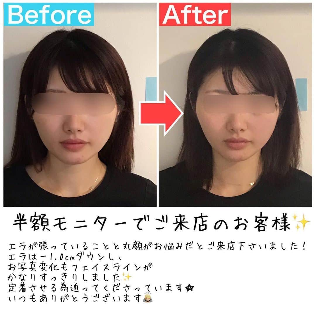 小顔科学研究所 のインスタグラム