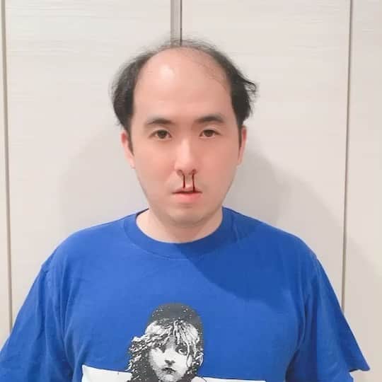 斎藤司のインスタグラム：「東京アラート出たよ とてもリアルな鼻血はアプリです。 #斎藤アラート発動中 #ドキドキはお預けだな #ほんとに意味が分からなくてごめんなさい #トッケビ #昨日やっと見終わった #ほんとに苦しかった #演者にあいたすぎ #キムゴウン さん #すぐフォローした笑 #つぎはジャーマネに勧められた #花郎 #見るよ #長いらしいけど」