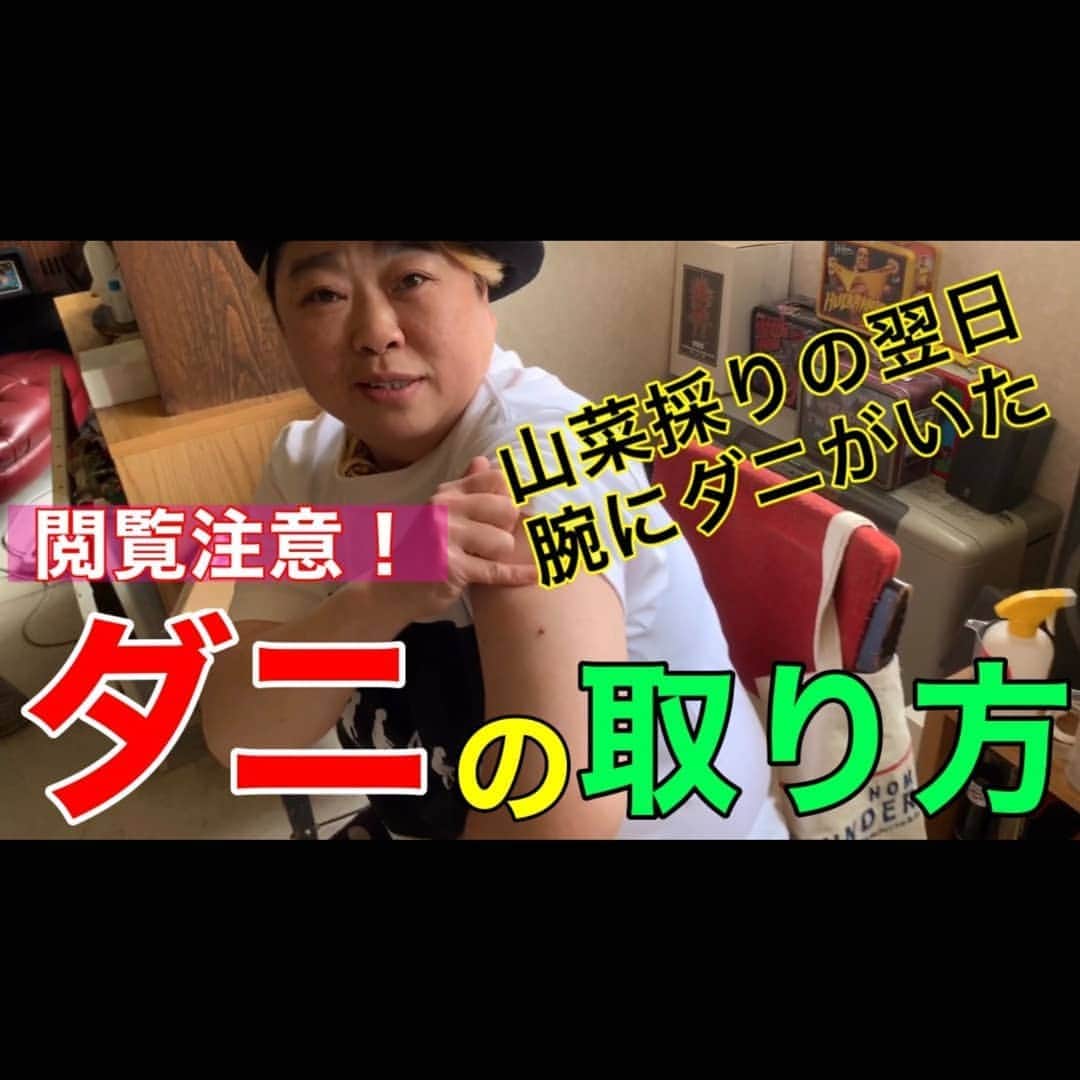 のインスタグラム：「ここで騒いだ後、更に喰われてました😭為になるキモ動画だに‼️ #アリモリキャンプ #YouTube #YouTuber #ダニ #マダニ #ダニ捕り #鮫肌 #サメ対ダニ #キモい #閲覧注意 #ゴールデンルーズありちゃん」