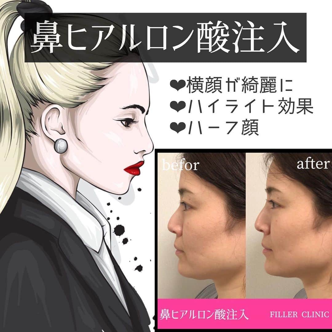 恵比寿フィラークリニックのインスタグラム