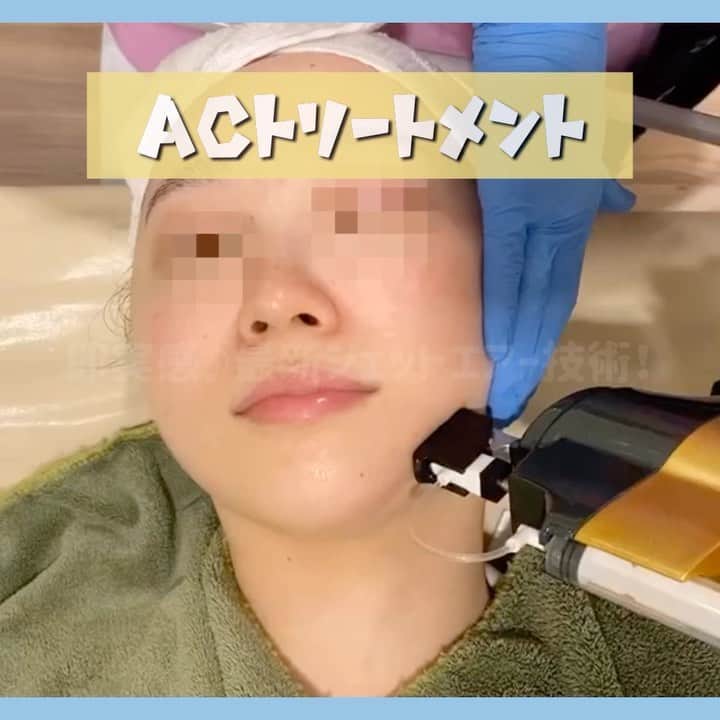 オラクル美容皮膚科東京新宿院のインスタグラム
