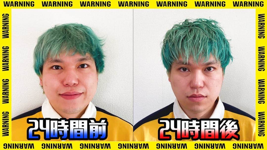 相馬トランジスタのインスタグラム：「ゴッドハンド整体師に24時間小顔マッサージをしてもらった結果  #トランジスタ史上最小顔」