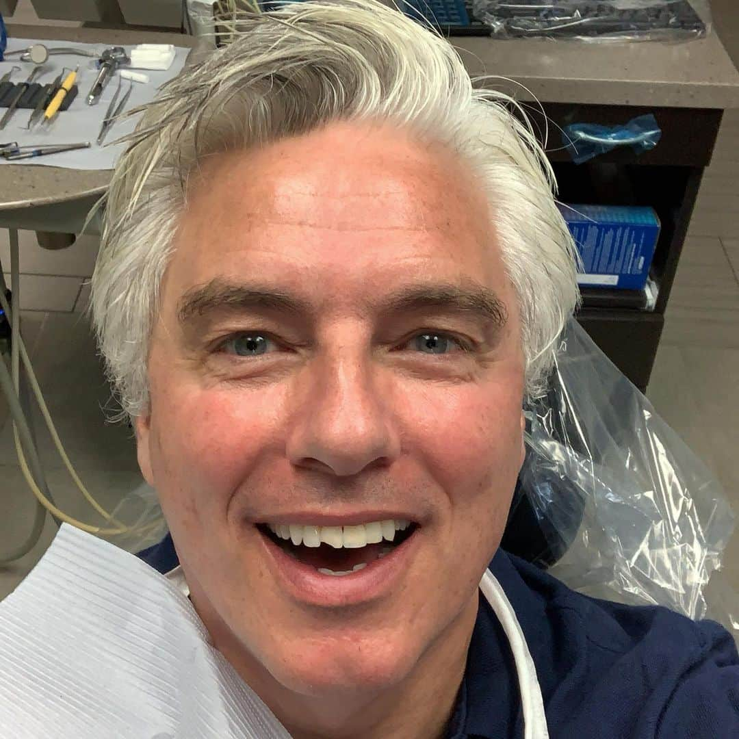 ジョン・バロウマンさんのインスタグラム写真 - (ジョン・バロウマンInstagram)「The chipped tooth is getting fixed today. Jb」5月14日 0時21分 - johnscotbarrowman