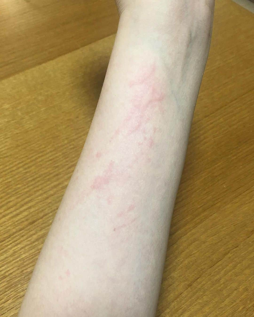 ルフさんのインスタグラム写真 - (ルフInstagram)「I just had my arm taken by #barher few minutes,and then my arm was allergy... My skin really allergic to cats hair... so i moved him on my lap, that’s why every summer I always shave my baby cats and i wear pants at home 😅😅 - - #cat #familylove #lovecats」5月18日 23時02分 - lanlan731