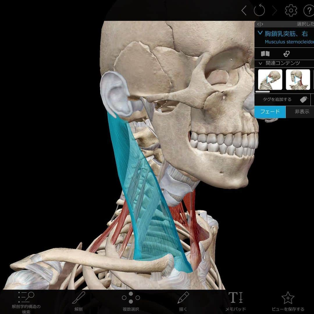 kogao283さんのインスタグラム写真 - (kogao283Instagram)「胸鎖乳突筋 及び その周辺の深層筋が 姿勢などにより凝り固まると 赤い箇所が連鎖的に痛みやだるさを生じることがございます。  首に負担がかかる姿勢はなるべく控えて下さいね。  当店及びスクール卒業サロンでは お顔以外にもしっかりとケアさせて頂きます。」5月19日 13時10分 - kogao283