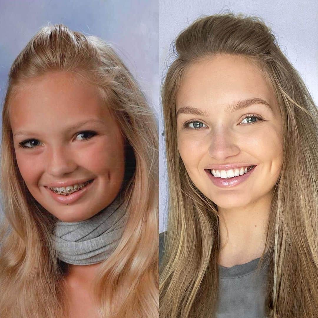 ロミー・ストリドのインスタグラム：「14 VS 24 years old 🤗」