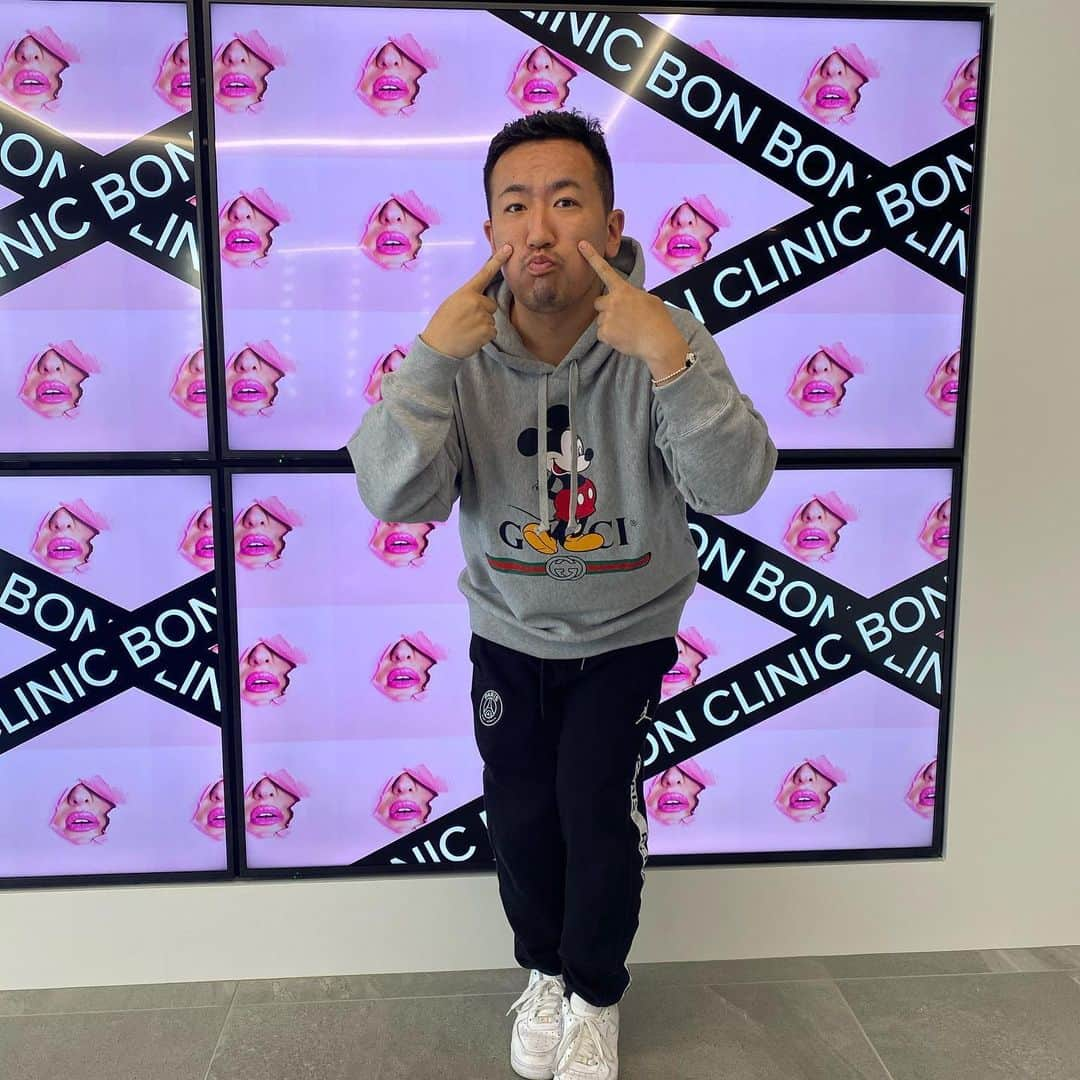 ゆっこママさんのインスタグラム写真 - (ゆっこママInstagram)「先日、銀座BONBONクリニック @bonbonclinic  にて、ハイフとPRPヴァンパイアフェイシャルダーマペンを受けてきました〜。 ライブ配信などで毛穴が気になってたので施術してきました♡  ヴァンパイアフェイシャルは ダーマペンの中でも最強で  採血した自分の血液から製剤をつくってそれをもとにやるかんじ！  よくわかんないよね！  ホームページ見に行ってきて。笑  麻酔クリームして、施術したとこが動画にもあるので見てみてね〜  営業時間も短くなってて、お客さんも組数限定でかぶらないようになってるので、予約時は要注意！！！ #bonbonclinic  #ダーマペン #prpヴァンパイアフェイシャル  #痛いwww #ダウンタイム #美肌 #銀座 #美活 #かつどん #どん兵衛 #美容皮膚科  #最先端治療 #知らんけど #毛穴 #スキンケア #あとなに #もういいか #ラグビー部好き #彼氏欲しい #幸せにするよ」5月21日 20時51分 - yukkomama_official