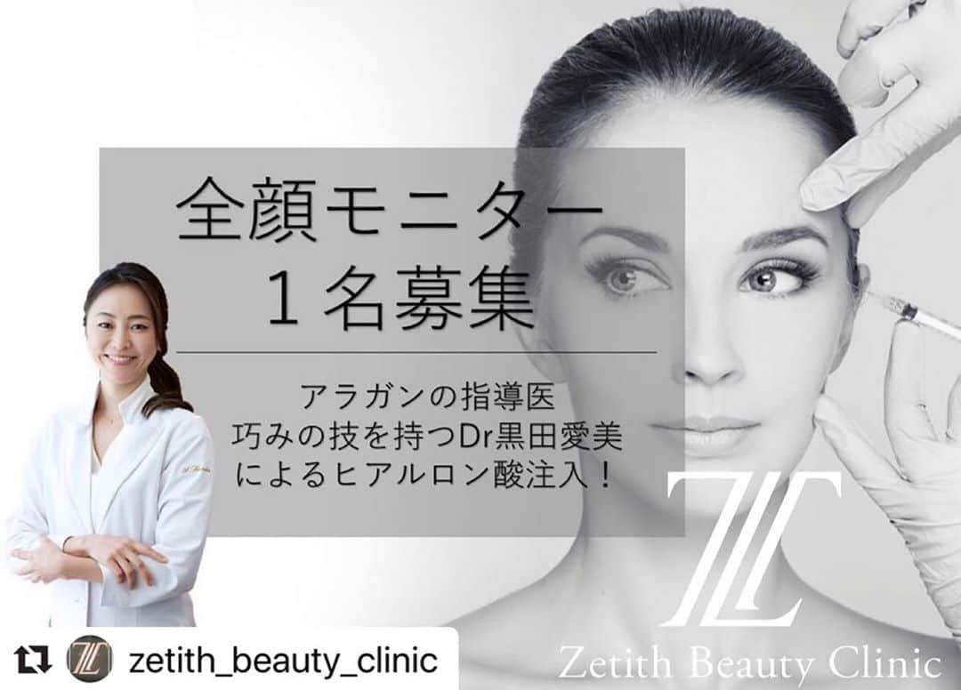 黒田愛美さんのインスタグラム写真 - (黒田愛美Instagram)「#Repost @zetith_beauty_clinic with @make_repost ・・・ 全顔モニター1名限定募集をさせて頂きます🌹﻿ ﻿ アラガンの指導医!! ﻿ 注入のスペシャリストDr黒田愛美によるヒアルロン酸注入の凄さを皆様に知って頂きたく、実際にインスタライブでお届けしようと思います😌☝️﻿ ﻿ その為、モニターを募集させて頂きます💋﻿ ﻿ ﻿ 🕧日時：6月5日  18:00〜スタート﻿ (6月5日  17:00〜来院出来る方のみ。かつインスタライブで生配信の為、全顔を出せる方のみに限る)﻿ 💉施術内容：ヒアルロン酸注入﻿ 💋対象条件：法令線、ゴルゴ線や頬のコケ、またはお顔のたるみが気になる方﻿ 💴料金：1cc ￥25,000+tax﻿ (通常価格 ￥130,000+tax)  お顔の状態を拝見させて頂きまして、使用する量は人によって異なります。約5cc前後を予定しております。﻿ ﻿ 応募をしたい方に関しまして、先ずDMを送って頂くようお願い致します🙇🏻‍♀️内容としましては﻿ ①お名前フルネーム﻿ ②携帯の電話番号﻿ ③生年月日﻿ ④お顔のお写真5枚。加工していない写真でお願い致します。﻿ 正面(顔全体を含む1枚)﻿ 左右横向き45度（2枚）﻿ 左右横向き90度（2枚）﻿ ﻿ ﻿ こちらで確認をさせて頂きまして、是非お願いしたい方のみにご連絡をさせて頂きたいと思います😌❣️﻿ ﻿ また何かご不明な点などがございましたら、お問い合わせ下さいませ☎️﻿ それでは気になる方ご応募お待ちしております💁🏻‍♀️﻿ ﻿ ﻿ 📍Zetith beauty clinic ﻿ (ゼティス ビューティー クリニック)﻿ ☎️03-6271-0977﻿ 💻https://zetithbeautyclinic.com﻿ ﻿ ﻿ #zetithbeautyclinic﻿ #ゼティスビューティークリニック ﻿ #アラガン﻿ #法令線﻿ #ゴルゴ  #ヒアルロン酸  #ボトックス﻿ #プチ整形﻿ #ベビースキン﻿ #たるみ改善  #リフトアップ  #mdコード  #ツルツル﻿ #マシュマロ﻿ #スペシャリスト  #若返り効果  #ツヤ肌﻿ #ベビースキーン﻿ #ボリューマー  #エレクトロポレーション﻿ #イオン導入﻿ #指導医  #ジュビダーム  #再生医療 ﻿ #ボルベラ #美容アンチエイジング専門医 #ヒアルロン酸注入講師 #注入指導医 #黒田愛美」5月24日 11時40分 - kurodaaimi