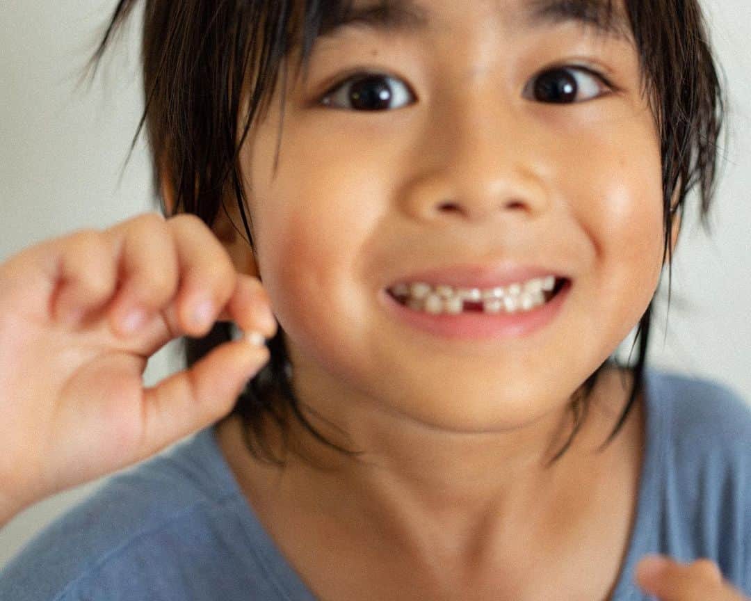 セソコマサユキのインスタグラム：「2020.5.24 歯が抜けたよー！  #沖縄 #okinawa #移住 #子育て」