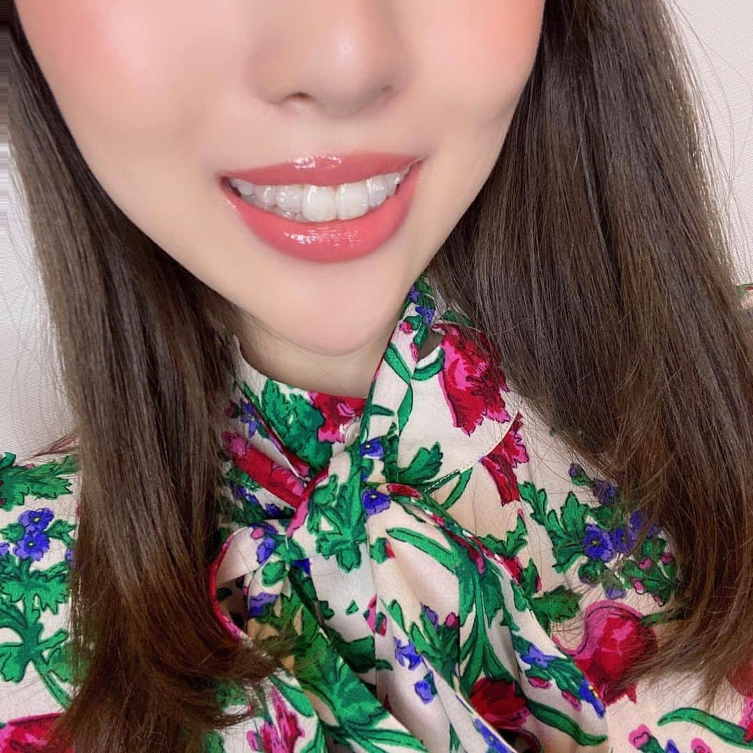 岡英里さんのインスタグラム写真 - (岡英里Instagram)「先月末から歯科矯正始めました🦷 . . うまくいくといいな。 . . #インビザライン #目立たない #歯科矯正 #透明 #マウスピース #歯並び #綺麗になりたい #コンプレックス #直したい #自己投資 #やっとできた #なかなか不便 #😂 #でも #頑張る #我慢 #アラサー #アラサー美容 #成功しますように #不安との戦い #わりと #痛い #🤣」5月29日 17時10分 - okaeri0424