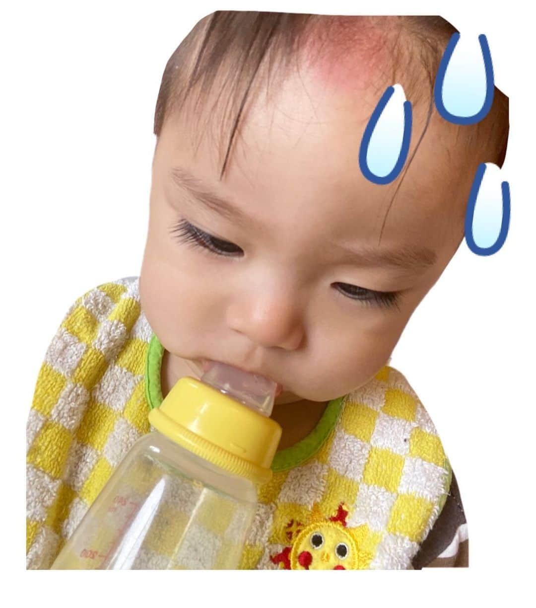 Momoeのインスタグラム：「. . 昨日網戸突き破って 下のコンクリにおでこから 落下していった人。 . 網戸破れるのは想像できず 助けられなかった...😢ｺﾞﾒﾝﾈ。 . 網戸に体重かけて お外見てたらそのまま破れて落ちた😢 . 落ちた瞬間 絶対ヤバイな血出てるな って思ったのに腫れてただけで （だけってのもおかしいけど） 全身確認した😭 . #7119 に電話して 病院行った方がいいのか相談したら 行くなら脳神経外科。 だけどすぐには症状が出ないから いつもと違う症状が出たら病院へとのこと。 . 主な症状としては ・泣き続ける ・手を握れない ・目が変な方向向いてる ・フラフラして転ぶ ・食欲がない ・吐き気、吐く などなどなど...。 . 5〜6時間様子見てたら いつもより泣くので病院へ😢 . レントゲンも撮ったけど 骨には異常なし。 . 赤ちゃんがCTを撮るのは リスクが高すぎるとのことなので 2〜3ヶ月様子を見てくださいだそうです😢 . 48時間はお風呂にも入れちゃダメ、 外出禁止。 （慢性硬膜下血腫の可能性） . 怖すぎるけど 今の所はいつも以上に元気レベルなので 一安心しています😔💭 今わんわん見て大喜びしてる🐕 . 脳に異常がある場合は 笑えないって言ってたから 大丈夫かな😢 . 1メートル以上の高さから落ちたら ヤバイらしい😭 うちは多分30〜40センチくらい😭 （それでも勢いヤバかった） . 網戸って破れるらしいので、、 小さなお子様がいらっしゃるご家庭は 本当に本当に 気をつけて見てあげてください、、。 . 同じ怪我がおこりませんように😭 . . （今日会える予定だったえり姉、たつ兄 本当に申し訳ない😢😢😢） . . .  #happy #家事 #育児 #family #家族 #boy #smile #男の子 #息子 #code #love #lucky #kids #子供 #thankyou #宝物 #ベビー #fashion #follow #心 #縁 #パパ #ママ #家族写真 #男の子ママ #赤ちゃん写真 #photo #子育て #1歳」