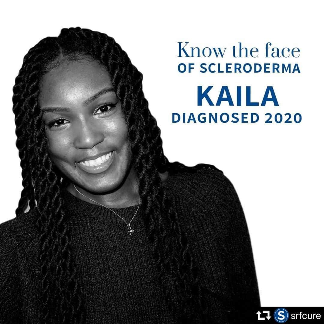 ボブ・サゲットさんのインスタグラム写真 - (ボブ・サゲットInstagram)「What a brave wonderful person Kaila Lipford is. As a proud Board Member of the Scleroderma Research Foundation, our goal is to help Kaila and all those affected by scleroderma, the disease that took my sister’s life. If you are able, please give if you can to our annual Spring Research Challenge. All gifts made through July 15th will be matched so your impact is doubled. Go to SRFcure.org to help. And please read on to learn more about the very brave Kaila Lipford. repost @srfcure ・・・ “Every month should be Racism Awareness Month,” remarks Kaila Lipford. “I say that because while I now have a scleroderma battle to fight, I still also have a race battle to fight and it’s helpful to know that the scleroderma community stands with every Black person facing this disease.” Read Kaila's story at https://bit.ly/KailaLipford . . #srfcure #sclerodermaresearch #ResearchistheKey #sclerodermaresearchfoundation #scleroderma」6月28日 7時23分 - bobsaget