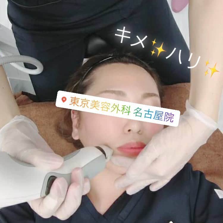 東京美容外科公式さんのインスタグラム写真 - (東京美容外科公式Instagram)「東京美容外科名古屋院です🌞💕 本日はイントラジェンのご紹介✨  お顔全体にラジオ波をお肌に照射する治療です😌🌸 🤍引き締め効果：真皮層にラジオ波を、照射すると熱でコラーゲン繊維が収縮することでたるんだ皮膚が引き締まります！ 🤍ハリ・リフトアップ効果：収縮したコラーゲン繊維が修復する過程で新しいコラーゲンが再構築されるため、肌のハリやリフトアップ効果がきたいできます！  それ以外にも…シワや毛穴にも効果あり💕気になるお目元のシワにも抜群に効きます🥺💗 次の日からお化粧ノリの良さを実感される方が続出💄 ⚠️注意事項 ・赤みが出ることがありますが、数日で落ち着きます。 ・洗顔、入浴、お化粧、シャワーは当日から可能性です。 ・痛みがある場合、治療後１〜２週間はエステなど強いマッサージを控えてください。  あなたもキメの細かいハリ肌を目指しましょう😍✨ http://bit.ly/36uXZD1 【東京美容外科 名古屋院】. . 〒450-0002 愛知県名古屋市中村区名駅3-25-3 大橋ビルディング1F ☎️052-562-1175 （電話受付時間:10:00〜19:00）. . .ㅤㅤㅤㅤㅤㅤㅤㅤㅤㅤㅤㅤ 【東京美容外科】. ==🎁お問い合わせはこちら🎁====﻿. 詳しくはプロフィールのURLから公式サイトへ♪﻿ ▼フリーダイヤル ☎0120-658-958 （コールセンター受付時間：9：00～21：00） . ▼LINE予約 @ tkc110 ============================== #東京美容外科#東京美容外科名古屋院　#美容外科#美容クリニック#美容好きと繋がりたい#小顔#小顔効果#部分痩せ#美肌#ハリツヤ#リフトアップ#イントラジェン#HIFU#美意識#ツヤ肌#綺麗になりたい#シワ改善#若返り#毛穴#美容皮膚科」6月8日 18時59分 - tokyobiyougeka_jimukyoku