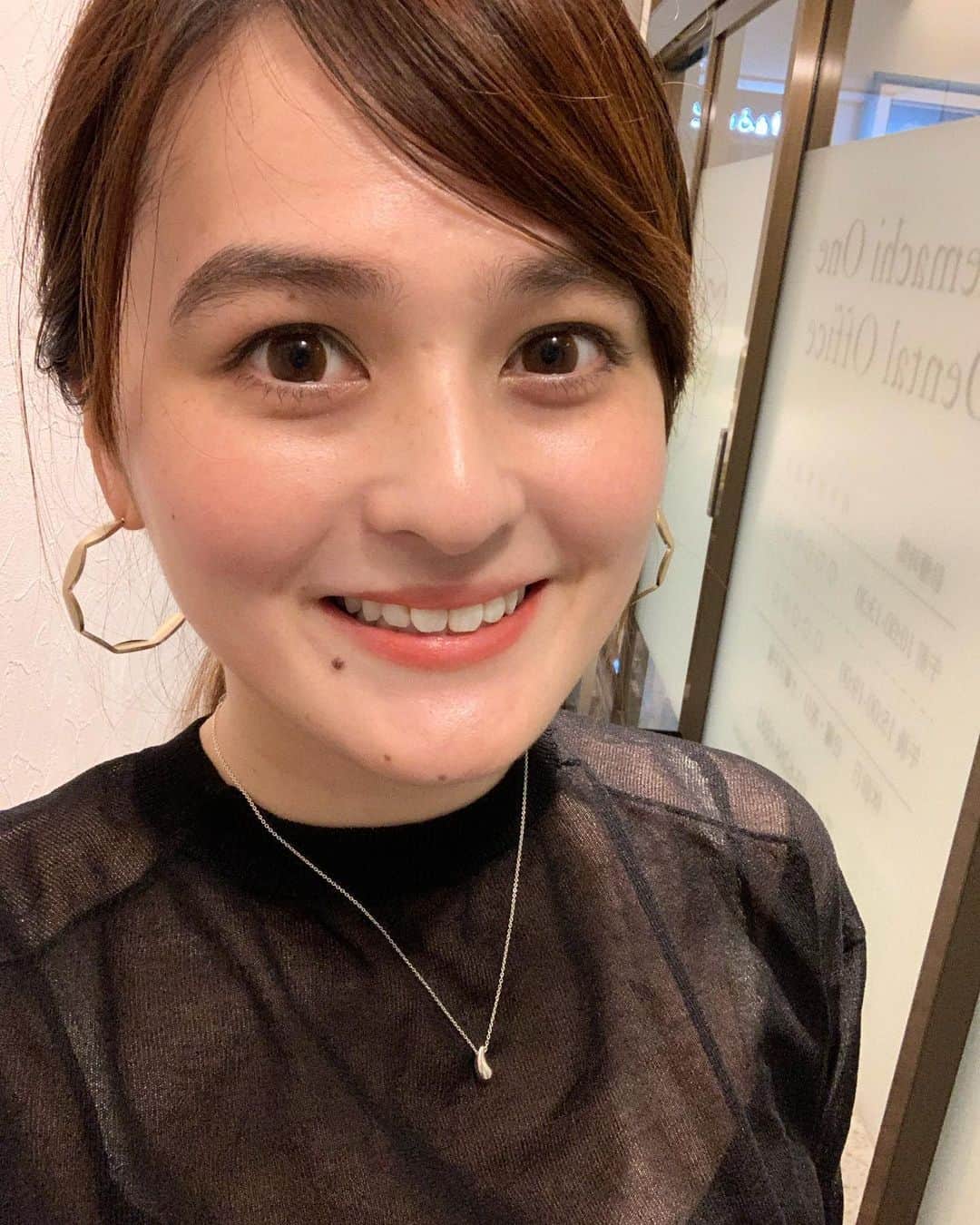 のインスタグラム：「歯🦷✨が白くてピカピカになりました😊 ・ コロナ自粛期間中、家でコーヒー☕️を飲みながら仕事をずっとしていたので、歯が黄色くなってきていました😨 ・ 歯を白くしてもらいたくて大手町にこれからオープンするビルの#otemachione の地下に、【6/8にオープンオープンしたばかりの#dentaloffice 】で#オフィスホワイトニング (@otemachi_one_dental_office)をしに行ってきました❣️C5出口直結だから嬉しい😆 ・ 先生に丁寧にカウンセリングをしていただき、#オフィスホワイトニング と#エアフロー を私はやっていただきました💓 ・ ✨写真についての説明✨ 1枚目　施術後、歯が白い！ 2枚目　携帯をしながらホワイトニングができる 3枚目　BeforeAfter(ちょっと分かりづらいですがトーンが2個くらい下がりました！) 4枚目　院内の動画 5枚目　携帯いじりながらをあらわしたくて撮ってもらったら、ちょっと滑稽な図に笑 6枚目　価格表と7/31まで10%offらしい😍 ・ 私は元々定期的にメンテナンスをしていたので、通常よりは白をキープできてたみたいですが、それでも白くなれてセラミック手前の色まで持ってくことができました🙋‍♀️✨ 歯は人の外見の中で唯一堂々と変えられる場所なので😂笑歯並びを良くして、白くすることってやっぱりとっても大事だと思いました。 ・ まだ開店したばかりでインスタのアカウントとか出来てないので、住所とURLをのせておきます🙋‍♀️ ・ 住所📝 東京都千代田区大手町1-2-1 Otemachi One B1 ・ HP💻 https://otemachi1-dental.com ・・・ #ホワイトニング #歯医者 #大手町歯医者 #🦷 #歯が命 #otemachione #otemachione dentaloffice #大手町 #駅直結 #駅近 #駅近歯医者」