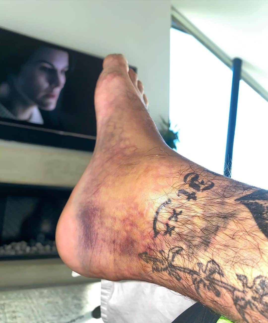 ナイジャ・ヒューストンさんのインスタグラム写真 - (ナイジャ・ヒューストンInstagram)「Man down😞」6月12日 10時36分 - nyjah