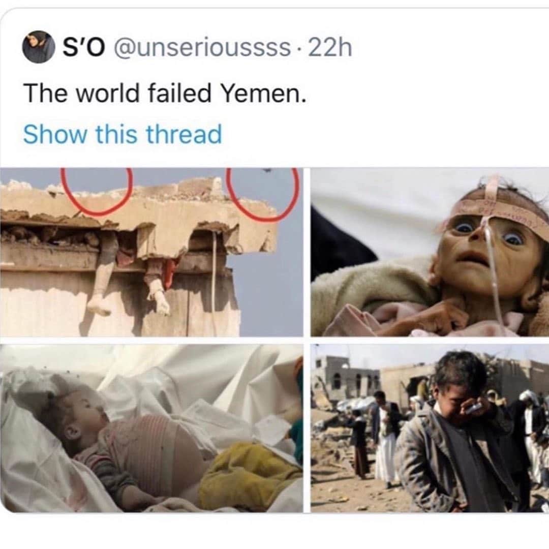 ティモシー・サイクスさんのインスタグラム写真 - (ティモシー・サイクスInstagram)「⚠️WARNING: GRAPHIC IMAGES⚠️ Repost from @karmagawa WE MUST GET URGENT HELP FOR THE PEOPLE IN YEMEN! Please share this post with your followers and tag people, celebrities, influencers & news media who need to see this because not enough people know that Yemen is the largest humanitarian crisis in the world, with more than 24 million people, 80% of the population, in need of humanitarian assistance right now, from food/water to shelter & medicine, including more than 12 million children, with one child dying every 10 minutes! We must work together to spread awareness about this crisis all over social media RIGHT NOW because with coronavirus now breaking out across the country, Yemen is facing an emergency within an emergency as sanitation, food and clean water are in short supply…with food prices doubling in the past month alone! There also aren’t enough health facilities operational, and many that are open lack the basics like masks and gloves, let alone the oxygen and medicine needed to treat patients. We at Karmagawa are proud to support & donate to @unicef and @unicef_yemen which has teams on the ground helping, but they need more funding by the end of June and that’ll only be possible when we all use our social media platforms to spread massive awareness about this crisis so please share these heartbreaking photos and videos with your followers, encourage them to also share with their followers too & tag celebrities, influencers and news media who need to see this and let’s make EVERYONE aware of this urgent crisis in Yemen that nobody is talking about but which will kill millions of people & children in the next few weeks/months if we do nothing, SO LET’S HELP YEMEN RIGHT NOW! #saveyemen #prayforyemen #yemen #karmagawa」6月15日 8時55分 - timothysykes