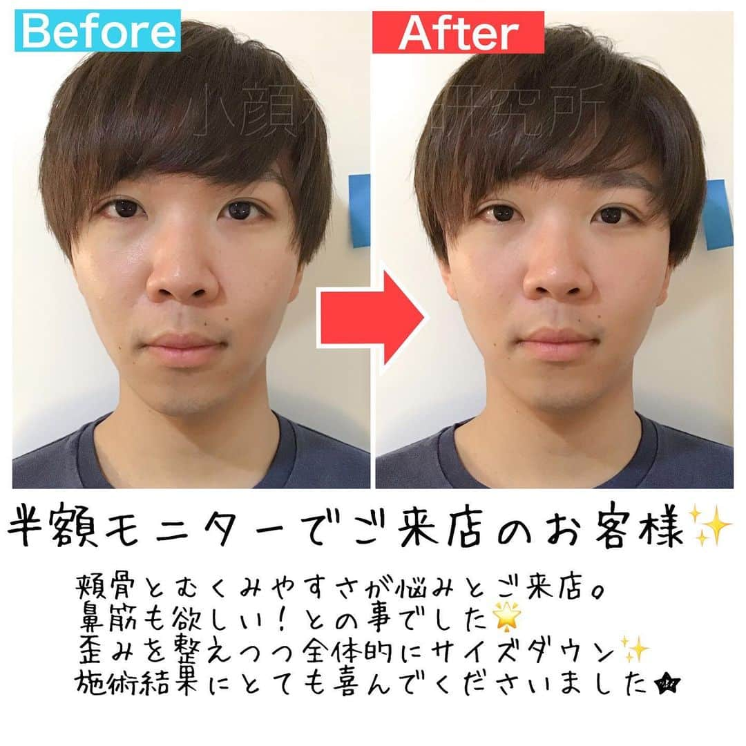 小顔科学研究所 のインスタグラム