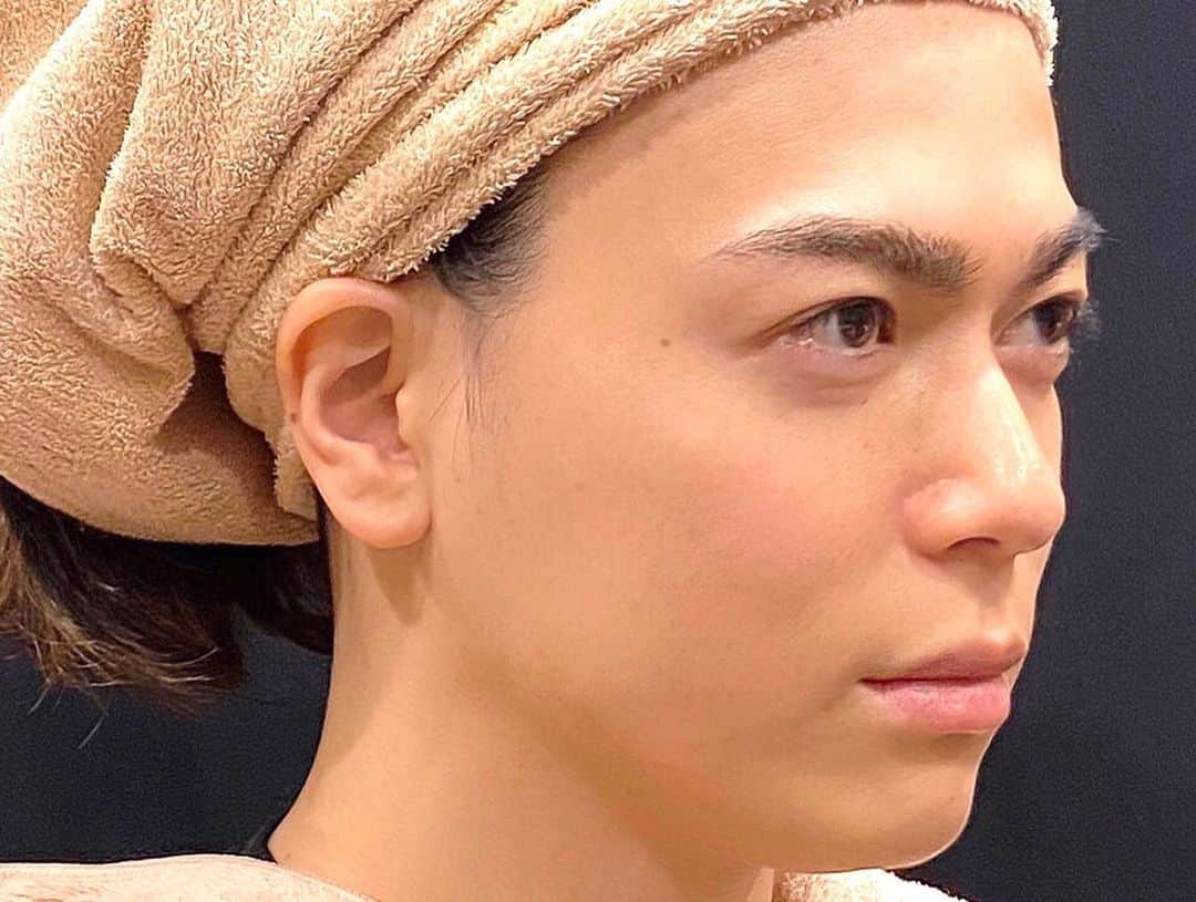 塩谷瞬さんのインスタグラム写真 - (塩谷瞬Instagram)「⭕東京美容皮膚科クリニックさんでメンテナンス。  最近めっちゃDMで美容のオススメ教えてください！と連絡が来るので、  紹介していきたいと思います。  まず感動したクリニック！  ウルセラ、サーマクールFLXの第一人者で有名な #東京美容皮膚科クリニック さん  初サーマクールFLX。 一瞬で引き締めタルミや浮腫が取れてスッキリ。  半顔で写真を撮ったら全然違いました！！！ そしてウルセラをポイントでやって頂きました、 ハイフ系の機械の中でも一番効果的に深層に熱を加えるのでWでやると効果が凄いんです！  そして二宮院長が最近一押しの女性の先生二人にアートメイクをやって頂きました！  男がアートメイク？って思うかもですが、 凄く自然で撮影や舞台の時もメイクさんの手間いらずで凄くいいい感じみたいなので 眉のアートメイク初挑戦してきました！  女性はいつもメイクの時間とかあると思うのでこれからの時期時短でオススメです。  #shunshioya #beauty #女子力男子 #アートメイク眉  #アートメイク #大和比 #ウルセラ #サーマクールFLX #hifu @tokyo_biyo_hifuka @tokyo_biyo_artmake」6月16日 11時01分 - shunshioya_official